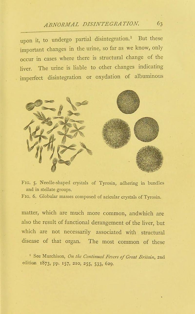 upon it, to undergo partial disintegration. 1 But these important changes in the urine, so far as we know, only occur in cases where there is structural change of the liver. The urine is liable to other changes indicating imperfect disintegration or oxydation of albuminous Fig. 5. Needle-shaped crystals of Tyrosin, adhering in bundles and in stellate groups. Fig. 6. Globular masses composed of acicular crystals of Tyrosin. matter, which are much more common, andwhich are also the result of functional derangement of the liver, but which are not necessarily associated with structural disease of that organ. The most common of these ' See Murchison, On the Continued Fevers of Great Britain, 2nd edition 1873, pp. 157, 210, 255, 533, 629.