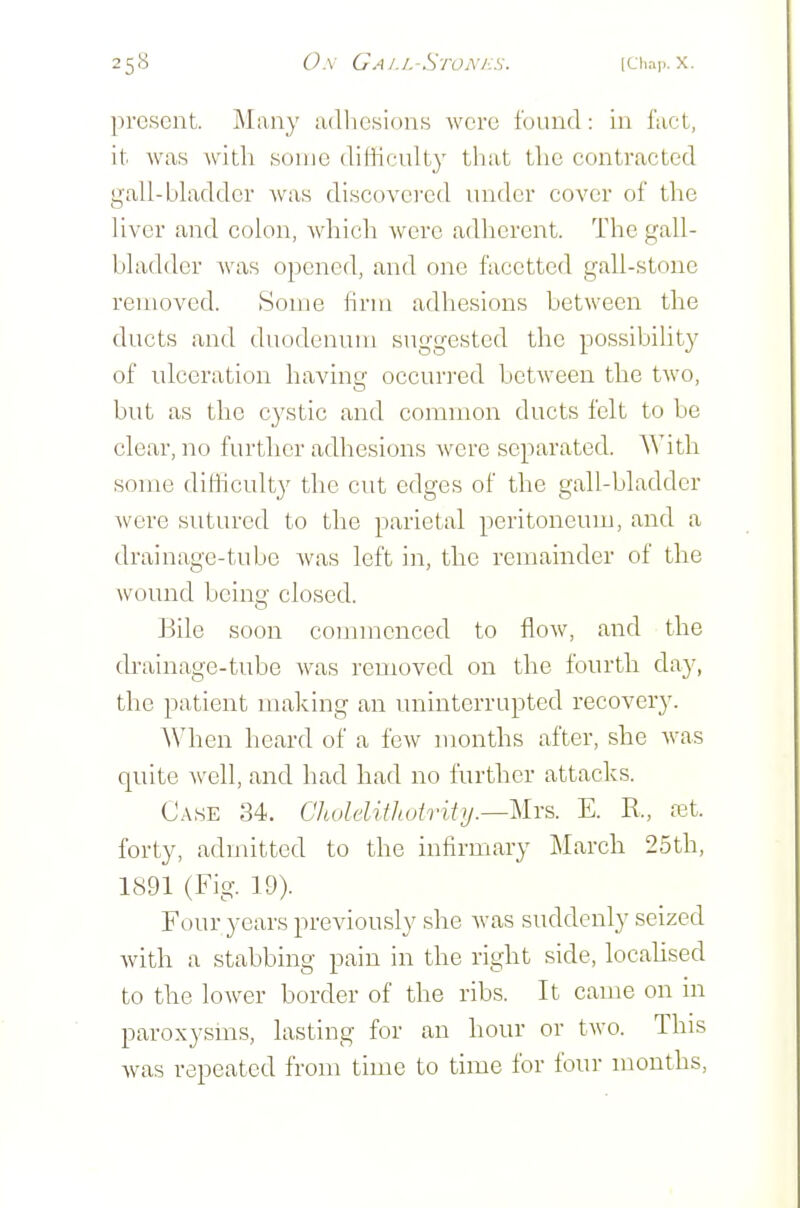 jiresent. Many adhesions were found: in fact, it. was witli sonic dilHeulty that tlic contracted gall-bladder was discovered under cover of the liver and colon, Avhich were adherent. The gall- bladder Avas opened, and one facetted gall-stone removed. Some firm adhesions between the ducts and duodenum suggested the possibility of idceration having occuri'ed between the two, but as the cystic and common ducts felt to be clear, no further adhesions were separated. With some ditliculty the cut edges of the gall-bladder were sutured to the parietal peritoneum, and a drainage-tube was left in, the remainder of the wound being closed. Bile soon commenced to flow, and the drainage-tube was removed on the fourth day, the patient making an uninterrupted recovery. When heard of a few months after, she was quite well, and had had no further attacks. Case 34. CholelUliutrity.—llr^. E. R., tet. forty, admitted to the infirmary March 25th, 1891 (Fig. 19). Four years previously she was suddenly seized with a stabbing pain in the right side, locahsed to the lower border of the ribs. It came on in paroxysms, lasting for an hour or two. This was repeated from time to time for four months,