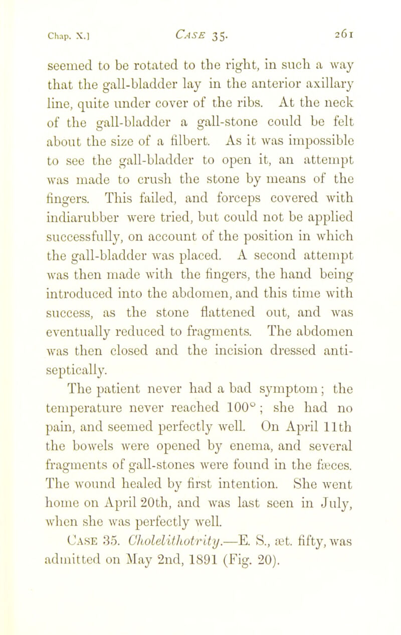 seemed to be rotated to the right, in such a way that the gall-bladder lay in the anterior axillary line, quite under cover of the ribs. At the neck of the gall-bladder a gall-stone could be felt about the size of a filbert. As it was impossible to see the gall-bladder to open it, an attempt was made to crush the stone by means of the fingers. This failed, and forceps covered with indiarubber were tried, but could not be applied successfully, on account of the position in which the gall-bladder was placed. A second attempt was then made with the fingers, the hand being- introduced into the abdomen, and this time with success, as the stone flattened out, and was eventually reduced to fi'agments. The abdomen was then closed and the incision dressed anti- septically. The patient never had a bad symptom ; the temperature never reached 100° ; she had no pain, and seemed perfectly well. On April 11th the bowels were opened by enema, and several fi'agments of gall-stones were found in the fk'ces. The wound healed by first intention. She went home on April 20th, and was last seen in July, when she was perfectly well. C.\SE 35. Cholelifhotrity.—E. S., a3t. fifty, was admitted on May 2nd, 1891 (Fig. 20).