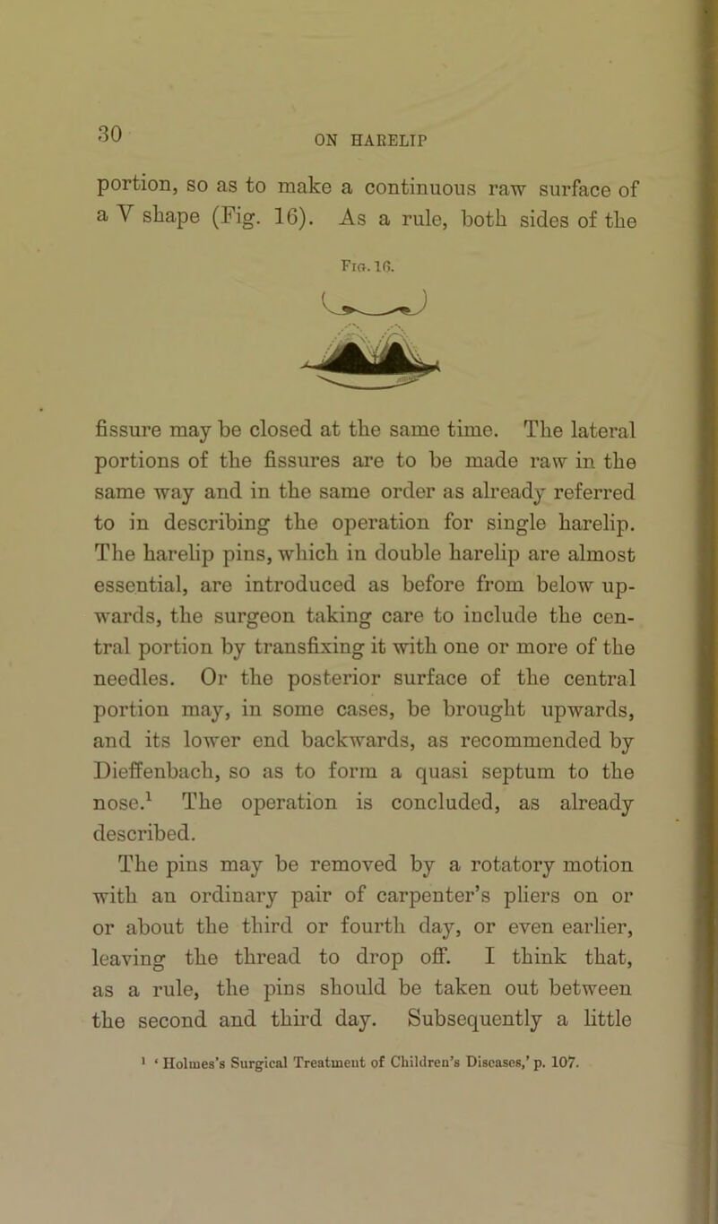 ON HARELIP portion, so as to make a continuous raw surface of a V shape (Fig. 16). As a rule, both sides of the Fig. in. fissure may be closed at the same time. The lateral portions of the fissures are to be made raw in the same way and in the same order as already referred to in describing the operation for single harelip. The harelip pins, which in double harelip are almost essential, are introduced as before from below up- wards, the surgeon taking care to include the cen- tral portion by transfixing it with one or more of the needles. Or the posterior surface of the central portion may, in some cases, be brought upwards, and its lower end backwards, as recommended by Dieffenbach, so as to form a quasi septum to the nose.^ The operation is concluded, as already described. The pins may be removed by a rotatory motion with an ordinary pair of carpenter’s pliers on or or about the third or fourth day, or even earlier, leaving the thread to drop off. I think that, as a rule, the pins should be taken out between the second and third day. Subsequently a little Holmes’s Surgical Treatment of Chililren’s Diseases,' p. 107.