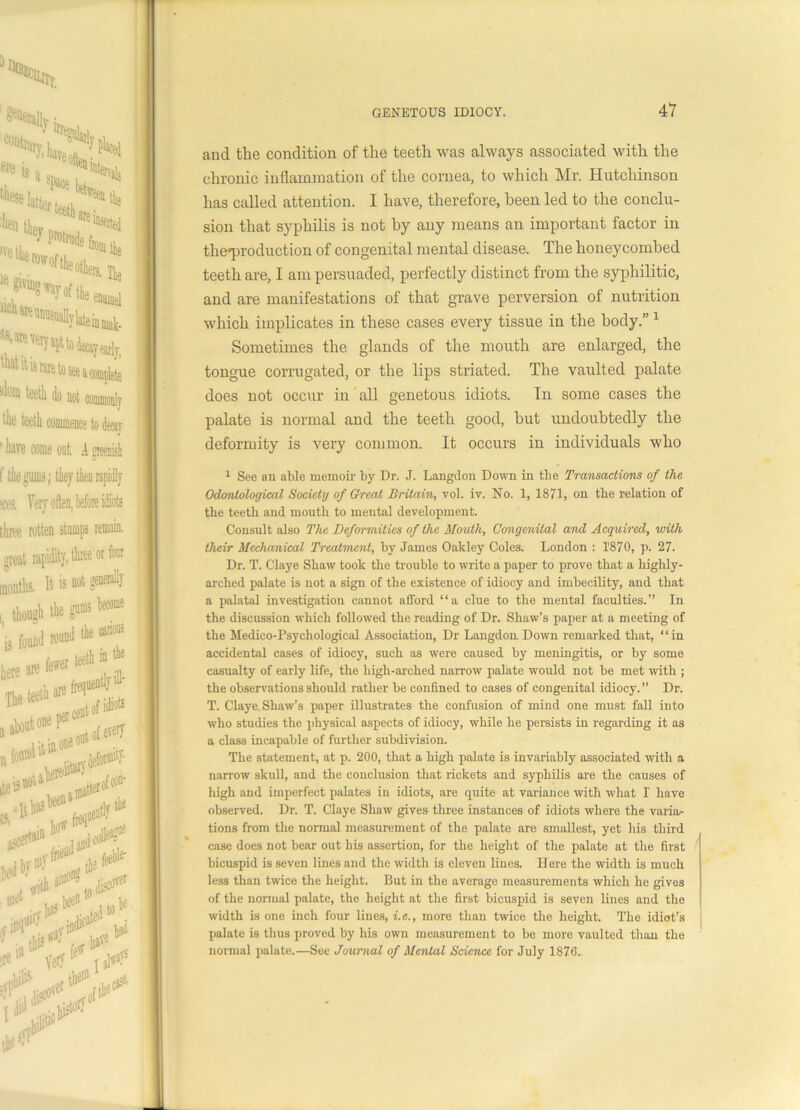 and the condition of the teeth was always associated with the chronic inflammation of the cornea, to which Mr. Hutchinson has called attention. I have, therefore, been led to the conclu- sion that syphilis is not by any means an important factor in the'production of congenital mental disease. The honeycombed teeth are, I am persuaded, perfectly distinct from the syphilitic, and are manifestations of that grave perversion of nutrition which implicates in these cases every tissue in the body.” 1 Sometimes the glands of the mouth are enlarged, the tongue corrugated, or the lips striated. The vaulted palate does not occur in all genetous idiots. Tn some cases the palate is normal and the teeth good, hut undoubtedly the deformity is very common. It occurs in individuals who 1 See an able memoir by Dr. J. Langdon Down in the Transactions of the Odontological Society of Great Britain, vol. iv. No. I, 1871, on the relation of the teeth and mouth to mental development. Consult also The Deformities of the Mouth, Congenital and Acquired, with their Mechanical Treatment, by James Oakley Coles. London : 1'870, p. 27. Dr. T. Claye Shaw took the trouble to write a paper to prove that a highly- arched palate is not a sign of the existence of idiocy and imbecility, and that a palatal investigation cannot afford “a clue to the mental faculties.” In the discussion which followed the reading of Dr. Shaw’s paper at a meeting of the Medico-Psychological Association, Dr Langdon. Down remarked that, “ in accidental cases of idiocy, such as were caused by meningitis, or by some casualty of early life, the high-arched narrow palate would not be met with ; the observations should rather be confined to cases of congenital idiocy.” Dr. T. Claye Shaw’s paper illustrates the confusion of mind one must fall into who studies the physical aspects of idiocy, while he persists in regarding it as a class incapable of further subdivision. The statement, at p. 200, that a high palate is invariably associated with a narrow skull, and the conclusion that rickets and syphilis are the causes of high and imperfect palates in idiots, are quite at variance with what I have observed. Dr. T. Claye Shaw gives three instances of idiots where the varia> tions from the normal measurement of the palate are smallest, yet his third case does not bear out his assertion, for the height of the palate at the first bicuspid is seven lines and the width is eleven lines. Here the width is much less than twice the height. But in the average measurements which he gives of the normal palate, the height at the first bicuspid is seven lines and the width is one inch four lines, i.e., more than twice the height. The idiot’s palate is thus proved by his own measurement to be more vaulted than the normal palate.—See Journal of Menial Science for July 1876..