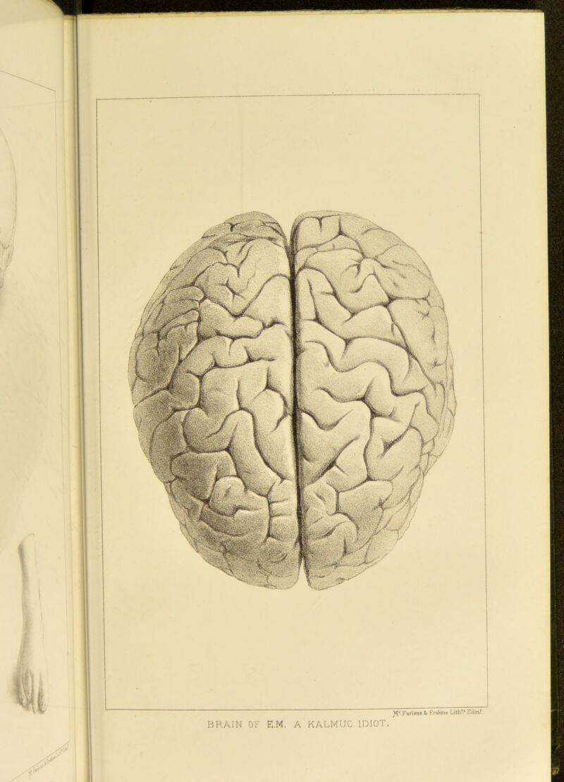 BRAIN OF E.M. A KALMUC IDIOT