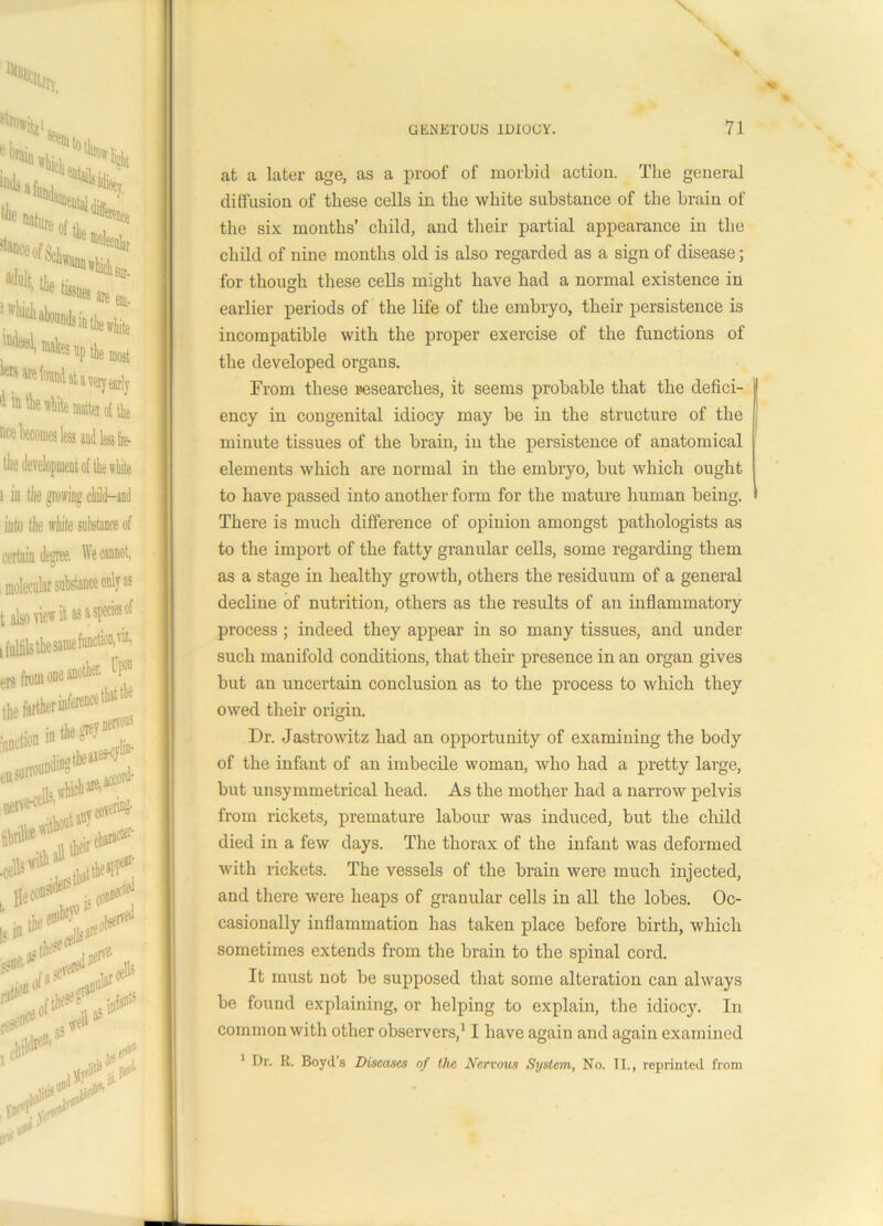 \ * at a later age, as a proof of morbid action. The general diffusion of these cells in the white substance of the brain of the six months’ child, and their partial appearance in the child of nine months old is also regarded as a sign of disease; for though these cells might have had a normal existence in earlier periods of the life of the embryo, their persistence is incompatible with the proper exercise of the functions of the developed organs. From these researches, it seems probable that the defici- ency in congenital idiocy may be in the structure of the minute tissues of the brain, in the persistence of anatomical elements which are normal in the embryo, but which ought to have passed into another form for the mature human being. There is much difference of opinion amongst pathologists as to the import of the fatty granular cells, some regarding them as a stage in healthy growth, others the residuum of a general decline of nutrition, others as the results of an inflammatory process; indeed they appear in so many tissues, and under such manifold conditions, that their presence in an organ gives but an uncertain conclusion as to the process to which they owed their origin. Dr. Jastrowitz had an opportunity of examining the body of the infant of an imbecile woman, who had a pretty large, but unsymmetrical head. As the mother had a narrow pelvis from rickets, premature labour was induced, but the child died in a few days. The thorax of the infant was deformed with I’ickets. The vessels of the brain were much injected, and there were heaps of granular cells in all the lobes. Oc- casionally inflammation has taken place before birth, which sometimes extends from the brain to the spinal cord. It must not be supposed that some alteration can always be found explaining, or helping to explain, the idiocy. In common with other observers,11 have again and again examined 1 Dr. R. Boyd’s Diseases of the Nervous System, No. II., reprinted from