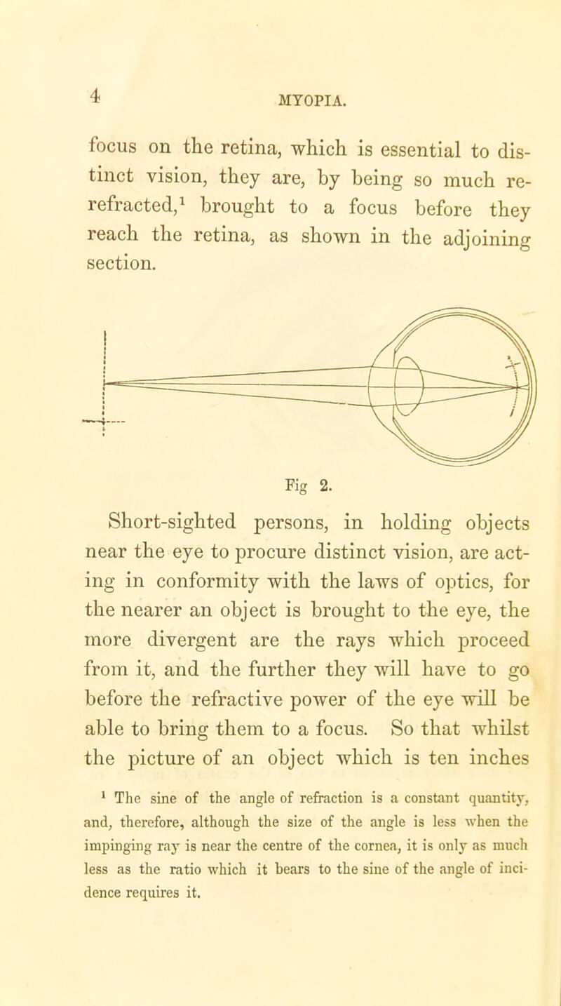 focus on the retina, which is essential to dis- tinct vision, they are, by being so much re- refracted,1 brought to a focus before they reach the retina, as shown in the adjoining section. Short-sighted persons, in holding objects near the eye to procure distinct vision, are act- ing in conformity with the laws of optics, for the nearer an object is brought to the eye, the more divergent are the rays which proceed from it, and the further they will have to go before the refractive power of the eye will be able to bring them to a focus. So that whilst the picture of an object which is ten inches 1 The sine of the angle of refraction is a constant quantity, and, therefore, although the size of the angle is less when the impinging ray is near the centre of the cornea, it is only as much less as the ratio which it bears to the sine of the angle of inci- dence requires it.
