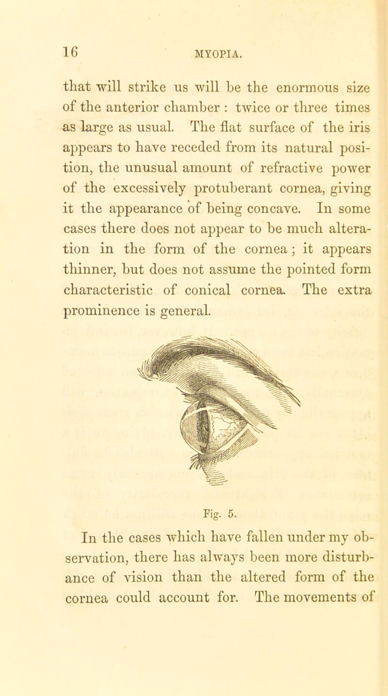 that will strike us will be the enormous size of the anterior chamber : twice or three times as large as usual. The flat surface of the iris appears to have receded from its natural posi- tion, the unusual amount of refractive power of the excessively protuberant cornea, giving it the appearance of being concave. In some cases there does not appear to he much altera- tion in the form of the cornea; it appears thinner, hut does not assume the pointed form characteristic of conical cornea. The extra prominence is general. In the cases which have fallen under my ob- servation, there has always been more disturb- ance of vision than the altered form of the cornea could account for. The movements of