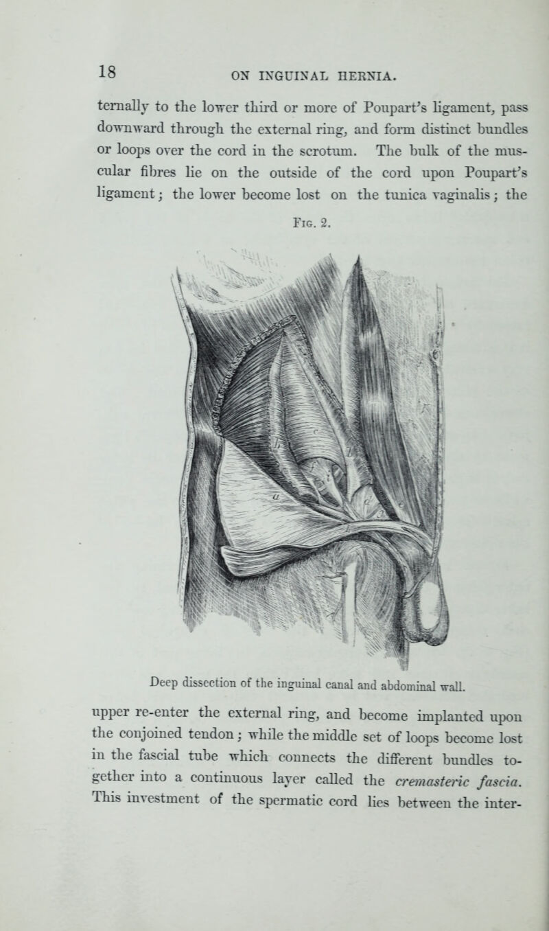 temally to the lower third or more of Poupart's ligament, pass downward through the external ring, and form distinct bundles or loops over the cord in the scrotum. The bulk of the mus- cular fibres lie on the outside of the cord upon Poupart's ligament; the lower become lost on the tunica vaginalis; the Fig. 2. Deep dissection of the inguinal canal and abdominal wall. upper re-enter the external ring, and become implanted upon the conjoined tendon : while the middle set of loops become lost in the fascial tube which connects the different bundles to- gether into a continuous layer called the cremasteric fascia. This investment of the spermatic cord lies between the inter-