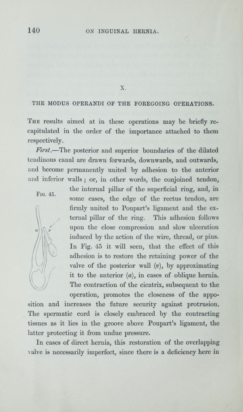 X. THE MODUS OPERANDI OF THE FOREGOING OPERATIONS. The results aimed at in these operations may be briefly re- capitulated in the order of the importance attached to them respectively. First.—The posterior and superior boundaries of the dilated tendinous canal are drawn forwards, downwards, and outwards, and become permanently united by adhesion to the anterior and inferior walls; or, in other words, the conjoined tendon, ^ the internal pillar of the superficial ring, and, in some cases, the edge of the rectus tendon, arc firmly united to Poupart's ligament and the ex- ternal pillar of the ring. This adhesion follows upon the close compression and slow ulceration induced by the action of the wire, thread, or pins. lg. 45 it will seen, that the effect of this adhesion is to restore the retaining power of the valve of the posterior wall (v), by approximating it to the anterior (a), in cases of oblique hernia. \v._yy The contraction of the cicatrix, subsequent to the operation, promotes the closeness of the appo- sition and increases the future security against protrusion. The spermatic cord is closely embraced by the contracting tissues as it lies in the groove above Poupart's ligament, the latter protecting it from undue pressure. In cases of direct hernia, this restoration of the overlapping valve is necessarily imperfect, since there is a deficiency here in