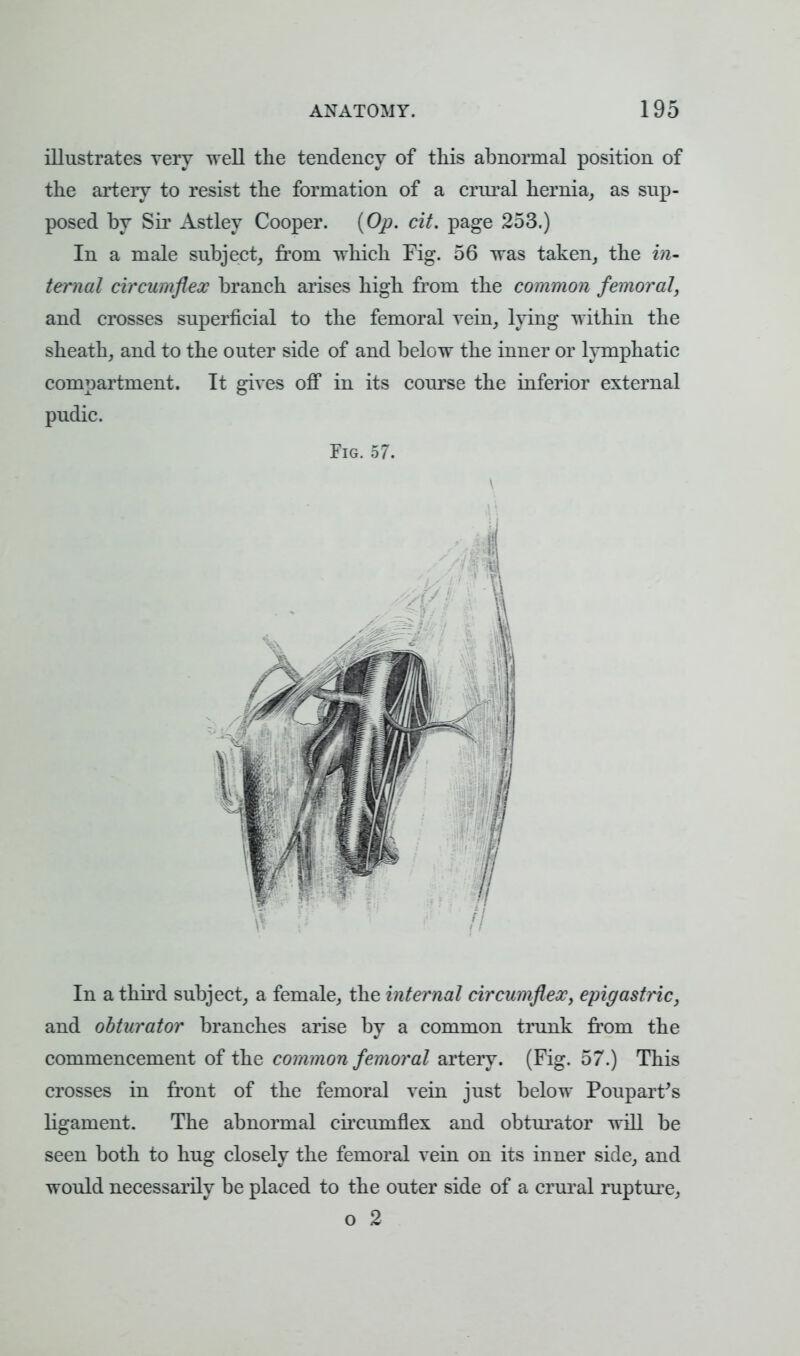 illustrates very well the tendency of this abnormal position of the artery to resist the formation of a crural hernia, as sup- posed by Sir Astley Cooper. [Op. cit. page 253.) In a male subject, from which Fig. 56 was taken, the in- ternal circumflex branch arises high from the common femoral, and crosses superficial to the femoral vein, lying within the sheath, and to the outer side of and below the inner or lymphatic compartment. It gives off in its course the inferior external pudic. Fig. 57. In a third subject, a female, the internal circumflex, epigastric, and obturator branches arise by a common trunk from the commencement of the common femoral artery. (Fig. 57.) This crosses in front of the femoral vein just below Pouparfs ligament. The abnormal circumflex and obturator will be seen both to hug closely the femoral vein on its inner side, and would necessarily be placed to the outer side of a crural rupture, o 2