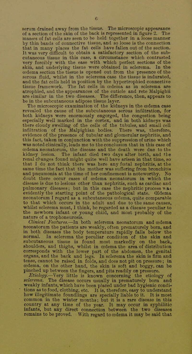 serum drained away from the tissue. The microscopic appearance of a section of the skin of the back is represented in figure 2. The masses of fat cells are seen to be held together in a loose manner by thin bands of connective tissue, and so loose is the connection that in many places the fat cells have fallen out of the section. It was very difficult to obtain a satisfactory section of the sub- cutaneous tissue in this case, a circumstance which contrasted very forcibly with the ease with which perfect sections of the skin, and underlying tissue were obtained in sclerema. In the ffidema section the tissue is opened out from the presence of the serous fluid, whilst in the sclerema case the tissue is indurated, and the fat cells held in position by the hypertrophied connective tissue framework. The fat cells in oedema as in sclerema are atrophied, and the appearances of the cuticle and rete Malpighii are similar in the two diseases. The difference, then, appears to be in the subcutaneous adipose tissue layer. The microscopic examination of the kidneys in the oedema case revealed the cause of the subcutaneous serous infiltration, for both kidneys were enormously engorged, the congestion being especially well marked in the cortex, and in both kidneys was there cloudy swelling of the cells of the tubules, and small cell infiltration of the Malpighian bodies. There was, therefore, evidence of the presence of tubular and glomerular nephritis, and this fact, taken in conjunction with the suppression of urine which was noted clinically, leads me to the conclusion that in this case of oedema neonatorum, the disease and the death were due to the kidney lesion. The infant died two days after birth, and the renal changes found might quite well have arisen in that time, so that I do not think there was here any foetal nephritis, at the same time the fact that the mother was suffering from bronchitis and pneumonia at the time of her confinement is noteworthy. No doubt there occur cases of oedema neonatorum in which the disease is due to lesions other than nephritis, such as cardiac and pulmonary diseases; but in this case the nephritic process ■vv as evidently the starting point of the pathological state. (Edema neonatorum I regard as a subcutaneous oedema, quite comparable to that which occurs in the adult and due to the same causes, whilst sclerema must, 1 think, be regarded as a disease peculiar to the newborn infant or young child, and most probably of the nature of a trophoneurosis. Clinical Features.—In both sclerema neonatorum and oedema neonatorum the patients are weakly, often prematurely born, and in both diseases the body temperature rapidly falls below the normal. In sclerema the peculiar condition of the skin and subcutaneous tissue is found most markedly on the back, shoulders, and thighs, whilst in oedema the area of distribution corresponds with the lower part of the abdomen, the genital organs, and the back and legs. In sclerema the skin is firm and tense, cannot be raised in folds, and does not pit on pressure; in oedema, on the other hand, the skin is soft and boggy, can be pinched up between the fingers, and pits readily on pressure. Etiology.—Very little is known concerning the etiology of sclerema. The disease occurs usually in prematurely born and weakly infants, which have been placed under bad hygienic condi- tions as to food, clothing, etc. It is, therefore, easy to understand how illegitimate foundlings are specially liable to it. It is most common in the winter months; but it is a rare disease in this country at any time of the year. It may occur in syphilitic infants, but any direct connection between the two diseases remains to be proved. With regard to oedema it may be said that