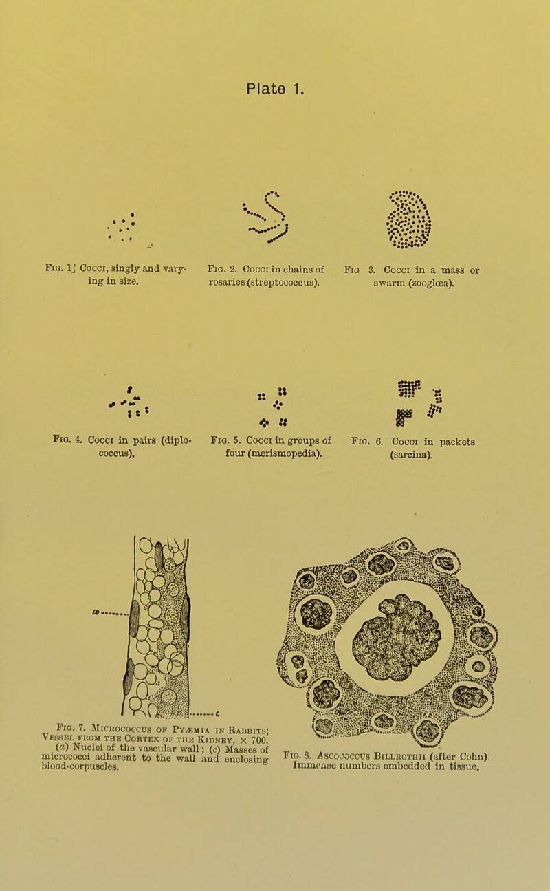 V Fio. 1 ■ Cocci, singly and vary- Fio. 2. Cocci in chains of Pia 3. Cocci in a mass or ing in size. rosaries (streptococcus). swarm (zoogloea). • „ » Iff- g r ^ Fio. 4. Cocci in pairs (diplo- Fig. 5. Cocci in groups of Fia. 6. Coooi in packets coccus), four (merismopedia). (sai-cina). Pio. 7. Micrococcus of Py/emia in Rabbits; Vessel from the Cortex of the Kidney, x 700. (a) Nuclei of the vascular wall; (c) Masses of micrococci adherent to the waU and enclosing blood-corpuscles. Pio. 8. ^scooocccs BiLLHOTHii (after Cohn). Immense numbers embedded in tissue.