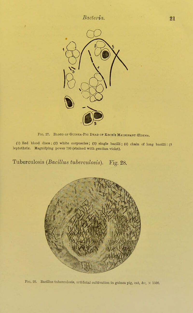 Fig. 27. Blood or Guinea-Pig Dead of Koch'b Malignant (Edema. (1) Red Wood discs ; (2) white corpuscles; (3) single bacilli; (4) chain of long baciUi: (} leptothrix. Magnifying power TOO (stained with gentian violet). Tuberculosis (Bacillus tuberculosis). Fig. 28. Fio, 28. Bacillus tuberculosis, artiaclaJ cultivation in guinea pig, cat, tic, x 1000.