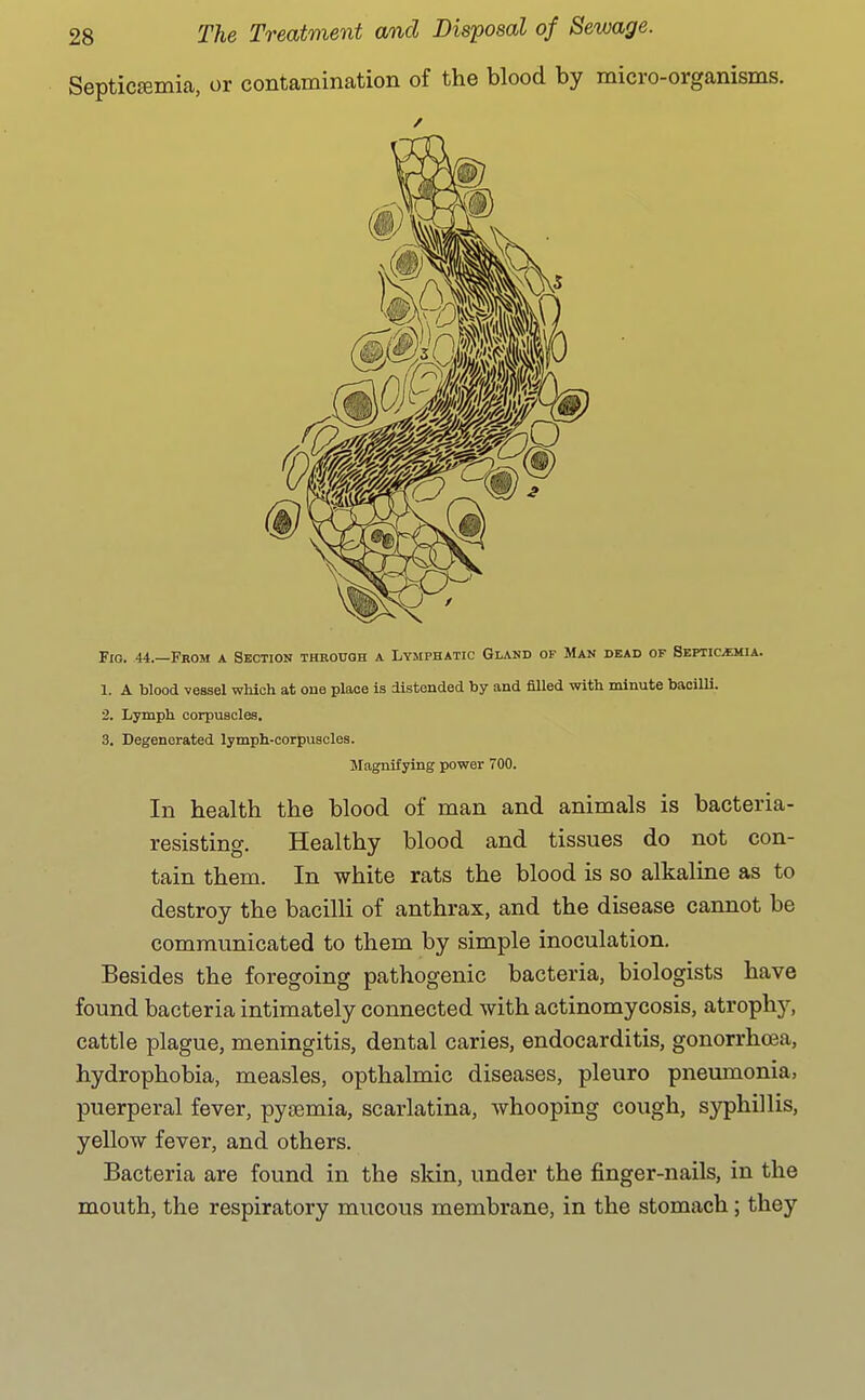 SepticEemica, or contamination of the blood by micro-organisms. Fig. 44.—From a Section through a Lymphatic Gland of Man dead of Septic^ia. 1. A blood vessel which at one place is distended by and filled with minute bacilli. 2. Lymph corpuscles. 3. Degenerated lymph-corpuscles. Magnifying power 700. In health the blood of man and animals is bacteria- resisting. Healthy blood and tissues do not con- tain them. In white rats the blood is so alkaline as to destroy the bacilli of anthrax, and the disease cannot be communicated to them by simple inoculation. Besides the foregoing pathogenic bacteria, biologists have found bacteria intimately connected with actinomycosis, atrophy, cattle plague, meningitis, dental caries, endocarditis, gonorrhoea, hydrophobia, measles, opthalmic diseases, pleuro pneumonia, puerperal fever, pyaemia, scarlatina, whooping cough, syphillis, yellow fever, and others. Bacteria are found in the skin, under the finger-nails, in the mouth, the respiratory mucous membrane, in the stomach; they