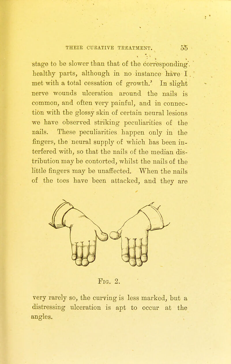 stage to be slower than that of the correspondirig'. healthy parts, although, in no instance Itave I. met with a total cessation of growth/ In slight nerve wounds ulceration around the nails is common, and often very painful, and in connec- tion with the glossy skin of certain neural lesions we have observed striking peculiarities of the nails. These peculiarities happen only in the fingers, the neural supply of which has been in- terfered with, so that the nails of the median dis- tribution may be contorted, whilst the nails of the little fingers may be unaffected. When the nails of the toes have been attacked, and they are Fig. 2. very rarely so, the curving is less marked, but a distressing ulceration is apt to occur at the angles.