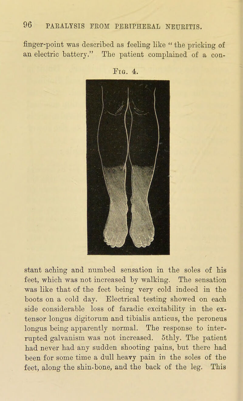 finger-point was described as feeling like “ tbe pricking of an electric battery.” Tbe patient complained of a con- Fig. 4. stant acbing and numbed sensation in the soles of his feet, which was not increased by walking. The sensation was like that of the feet being very cold indeed in the boots on a cold day. Electrical testing showed on each side considerable loss of faradic excitability in the ex- tensor longus digitorum and tibialis anticus, the peroneus longus being apparently normal. The response to inter- rupted galvanism was not increased. 5thly. The patient had never had any sudden shooting pains, but there had been for some time a dull heavy pain in the soles of the feet, along the shin-bone, and the back of the leg. This