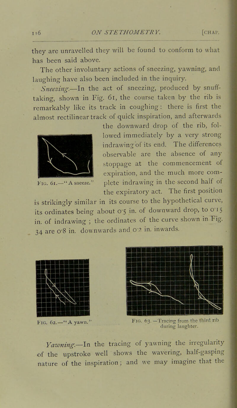 they are unravelled they will be found to conform to what has been said above. The other involuntary actions of sneezing, yawning, and laughing have also been included in the inquiry. Sneesi7tg.—In the act of sneezing, produced by snuff- taking, shown in Fig. 6i, the course taken by the rib is remarkably like its track in coughing: there is first the almost rectilinear track of quick inspiration, and afterwards the downward drop of the rib, fol- lowed immediately by a very strong indrawin'5-of its end. The differences observable are the absence of any stoppage at the commencement of expiration, and the much more com- plete indrawing in the second half of the expiratory act. The first position is strikingly similar in its course to the hypothetical curve, its ordinates being about 0-5 in. of downward drop, to O'lS in. of indrawing ; the ordinates of the curve shown in Fig. 34 are O'S in. downwards and 0 2 in. inwards. Fig. 61.—A sneeze. Fig. 62.—A yawn Fig. 63. —Tracing: from the third rib during laughter. Yawniftg—ln the tracing of yawning the irregularity of the upstroke well shows the wavering, half-gasping nature of the inspiration; and we may imagine that the