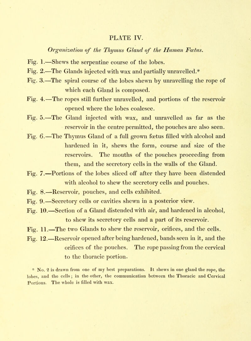 Organization of the Thymus Gland of the Human Foetus. Fig. 1.—Shews the serpentine course of the lobes. Fig. 2.—The Glands injected with wax and partially unravelled A Fig. 3.—The spiral course of the lobes shewn by unravelling the rope of which each Gland is composed. Fig. 4.—The ropes still further unravelled, and portions of the reservoir opened where the lobes coalesce. Fig. 5.—The Gland injected with wax, and unravelled as far as the reservoir in the centre permitted, the pouches are also seen. Fig. 6.—The Thymus Gland of a full grown foetus filled with alcohol and hardened in it, shews the form, course and size of the reservoirs. The mouths of the pouches proceeding from them, and the secretory cells in the walls of the Gland. Fig. 7.—Portions of the lobes sliced off after they have been distended with alcohol to shew the secretory cells and pouches. Fig. 8.—Reservoir, pouches, and cells exhibited. Fig. 9.—Secretory cells or cavities shewn in a posterior view. Fig. 10.—Section of a Gland distended with air, and hardened in alcohol, to shew its secretory cells and a part of its reservoir. Fig. 11.—The two Glands to shew the reservoir, orifices, and the cells. Fig. 12.—Reservoir opened after being hardened, bands seen in it, and the orifices of the pouches. The rope passing from the cervical to the thoracic portion. * N o. 2 is drawn from one of my best preparations. It shews in one gland the rope, the lobes, and the cells ; in the other, the communication between the Thoracic and Cervical Portions. The whole is filled with wax.