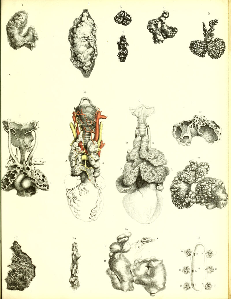 No text description is available for this image