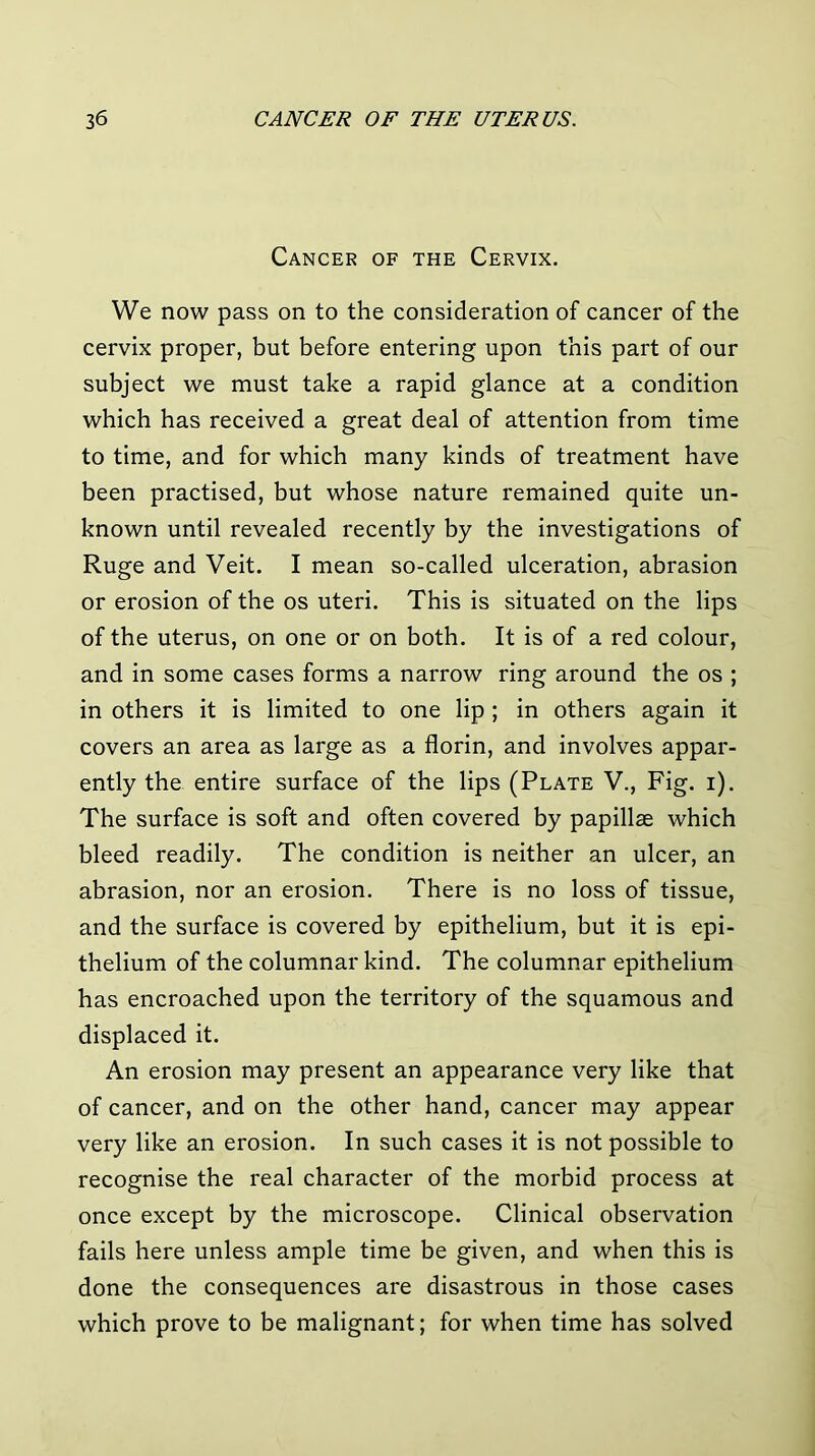 Cancer of the Cervix. We now pass on to the consideration of cancer of the cervix proper, but before entering upon this part of our subject we must take a rapid glance at a condition which has received a great deal of attention from time to time, and for which many kinds of treatment have been practised, but whose nature remained quite un- known until revealed recently by the investigations of Ruge and Veit. I mean so-called ulceration, abrasion or erosion of the os uteri. This is situated on the lips of the uterus, on one or on both. It is of a red colour, and in some cases forms a narrow ring around the os ; in others it is limited to one lip ; in others again it covers an area as large as a florin, and involves appar- ently the entire surface of the lips (Plate V., Fig. i). The surface is soft and often covered by papillae which bleed readily. The condition is neither an ulcer, an abrasion, nor an erosion. There is no loss of tissue, and the surface is covered by epithelium, but it is epi- thelium of the columnar kind. The columnar epithelium has encroached upon the territory of the squamous and displaced it. An erosion may present an appearance very like that of cancer, and on the other hand, cancer may appear very like an erosion. In such cases it is not possible to recognise the real character of the morbid process at once except by the microscope. Clinical observation fails here unless ample time be given, and when this is done the consequences are disastrous in those cases which prove to be malignant; for when time has solved