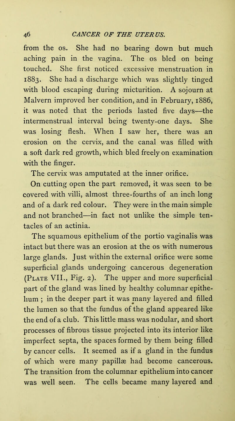 from the os. She had no bearing down but much aching pain in the vagina. The os bled on being touched. She first noticed excessive menstruation in 1883. She had a discharge which was slightly tinged with blood escaping during micturition. A sojourn at Malvern improved her condition, and in February, 1886, it was noted that the periods lasted five days—the intermenstrual interval being twenty-one days. She was losing flesh. When I saw her, there was an erosion on the cervix, and the canal was filled with a soft dark red growth, which bled freely on examination with the finger. The cervix was amputated at the inner orifice. On cutting open the part removed, it was seen to be covered with villi, almost three-fourths of an inch long and of a dark red colour. They were in the main simple and not branched—in fact not unlike the simple ten- tacles of an actinia. The squamous epithelium of the portio vaginalis was intact but there was an erosion at the os with numerous large glands. Just within the external orifice were some superficial glands undergoing cancerous degeneration (Plate VII., Fig. 2). The upper and more superficial part of the gland was lined by healthy columnar epithe- lium ; in the deeper part it was many layered and filled the lumen so that the fundus of the gland appeared like the end of a club. This little mass was nodular, and short processes of fibrous tissue projected into its interior like imperfect septa, the spaces formed by them being filled by cancer cells. It seemed as if a gland in the fundus of which were many papillae had become cancerous. The transition from the columnar epithelium into cancer was well seen. The cells became many layered and