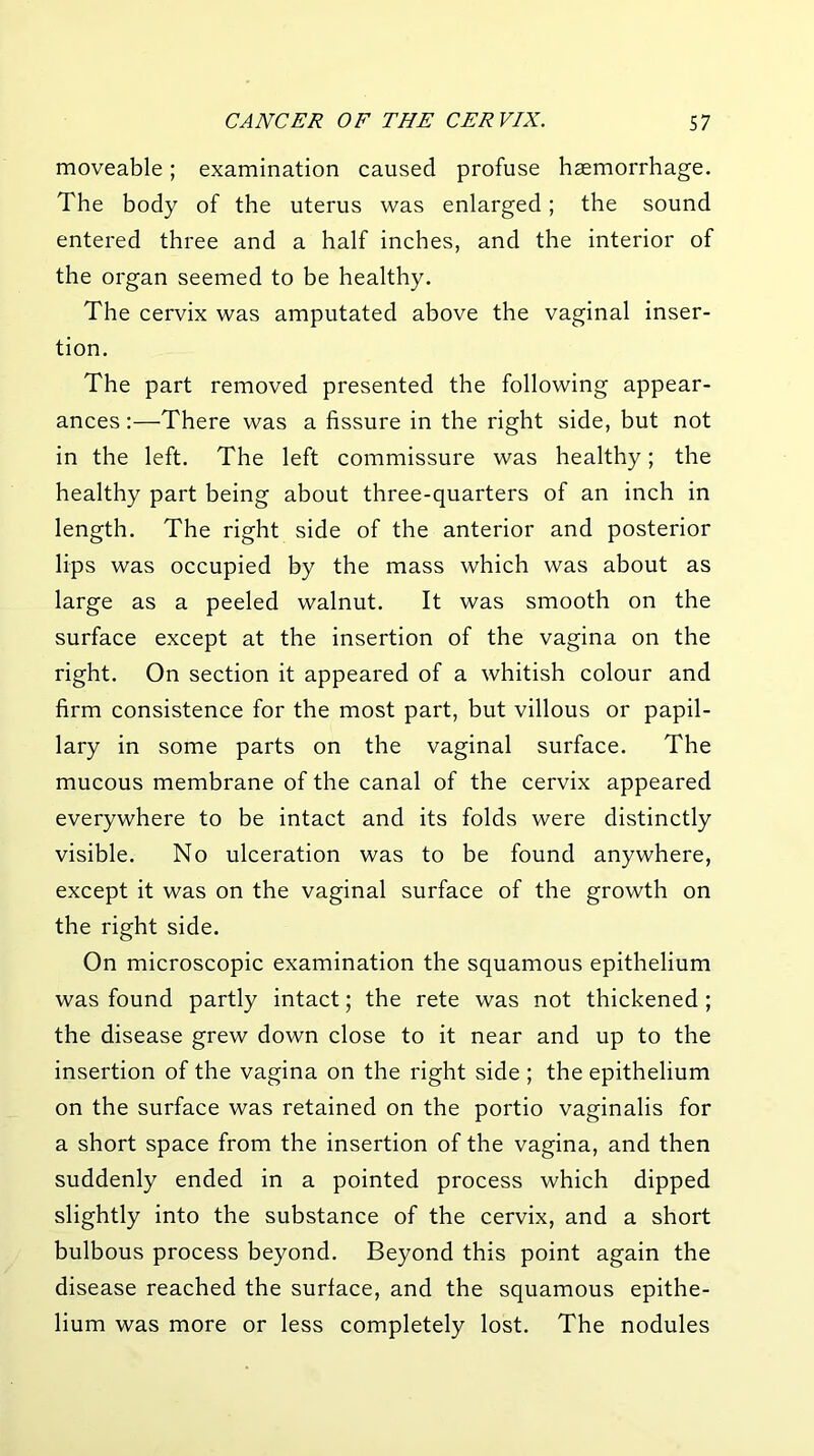 moveable; examination caused profuse haemorrhage. The body of the uterus was enlarged; the sound entered three and a half inches, and the interior of the organ seemed to be healthy. The cervix was amputated above the vaginal inser- tion. The part removed presented the following appear- ances :—There was a fissure in the right side, but not in the left. The left commissure was healthy; the healthy part being about three-quarters of an inch in length. The right side of the anterior and posterior lips was occupied by the mass which was about as large as a peeled walnut. It was smooth on the surface except at the insertion of the vagina on the right. On section it appeared of a whitish colour and firm consistence for the most part, but villous or papil- lary in some parts on the vaginal surface. The mucous membrane of the canal of the cervix appeared everywhere to be intact and its folds were distinctly visible. No ulceration was to be found anywhere, except it was on the vaginal surface of the growth on the right side. On microscopic examination the squamous epithelium was found partly intact; the rete was not thickened; the disease grew down close to it near and up to the insertion of the vagina on the right side ; the epithelium on the surface was retained on the portio vaginalis for a short space from the insertion of the vagina, and then suddenly ended in a pointed process which dipped slightly into the substance of the cervix, and a short bulbous process beyond. Beyond this point again the disease reached the surface, and the squamous epithe- lium was more or less completely lost. The nodules
