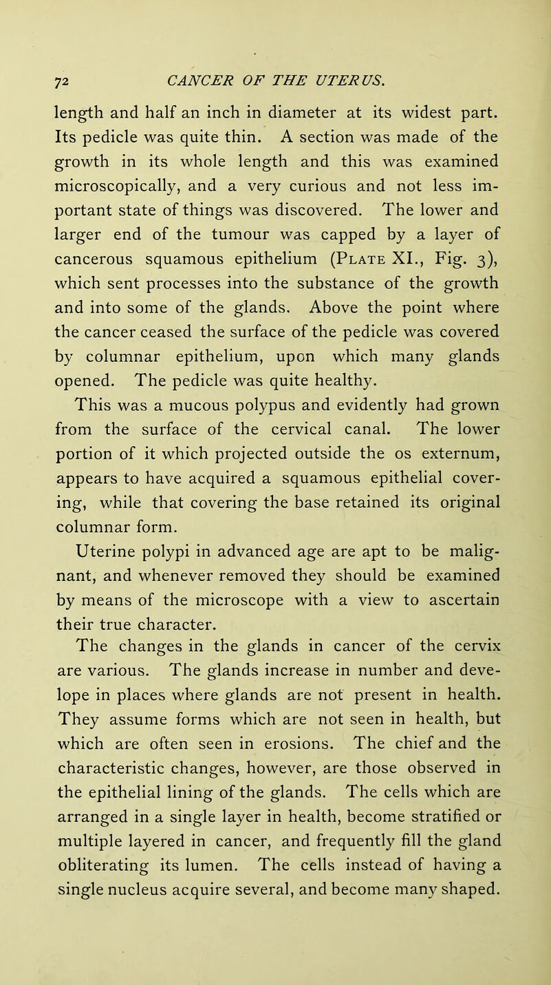 length and half an inch in diameter at its widest part. Its pedicle was quite thin. A section was made of the growth in its whole length and this was examined microscopically, and a very curious and not less im- portant state of things was discovered. The lower and larger end of the tumour was capped by a layer of cancerous squamous epithelium (Plate XL, Fig. 3), which sent processes into the substance of the growth and into some of the glands. Above the point where the cancer ceased the surface of the pedicle was covered by columnar epithelium, upon which many glands opened. The pedicle was quite healthy. This was a mucous polypus and evidently had grown from the surface of the cervical canal. The lower portion of it which projected outside the os externum, appears to have acquired a squamous epithelial cover- ing, while that covering the base retained its original columnar form. Uterine polypi in advanced age are apt to be malig- nant, and whenever removed they should be examined by means of the microscope with a view to ascertain their true character. The changes in the glands in cancer of the cervix are various. The glands increase in number and deve- lope in places where glands are not present in health. They assume forms which are not seen in health, but which are often seen in erosions. The chief and the characteristic changes, however, are those observed in the epithelial lining of the glands. The cells which are arranged in a single layer in health, become stratified or multiple layered in cancer, and frequently fill the gland obliterating its lumen. The cells instead of having a single nucleus acquire several, and become many shaped.