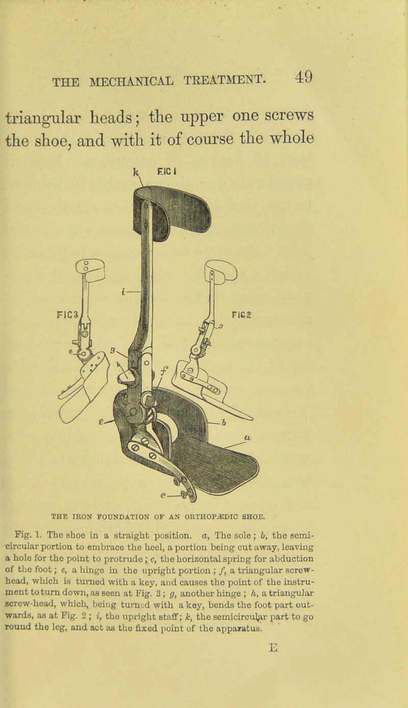 triangular heads; the upper one screws the shoe, and with it of course the whole k F-ICI THE IRON FOUNDATION OF AN ORTHOPiEDIO SHOE. Fig. 1. The shoe in a straight position, a, The sole; 6, the semi- circular portion to embrace the heel, a portion being cut away, leaving a hole for the point to protrude; c, the horizontal spring for abduction of the foot; e, a hinge in the upright portion ; /, a triangular screw- head, which is turned with a key, and causes the point of the instru- ment to turn down, as seen at Fig. 3; g, another hinge ; /i, a triangular screw-head, which, bciug tumid with a key, bends the foot part out- ward.s, as at Fig. 2 ; i, the upright staff; k, the semicircular part to go rouud the leg, and act as the fixed point of the apparatus'. E