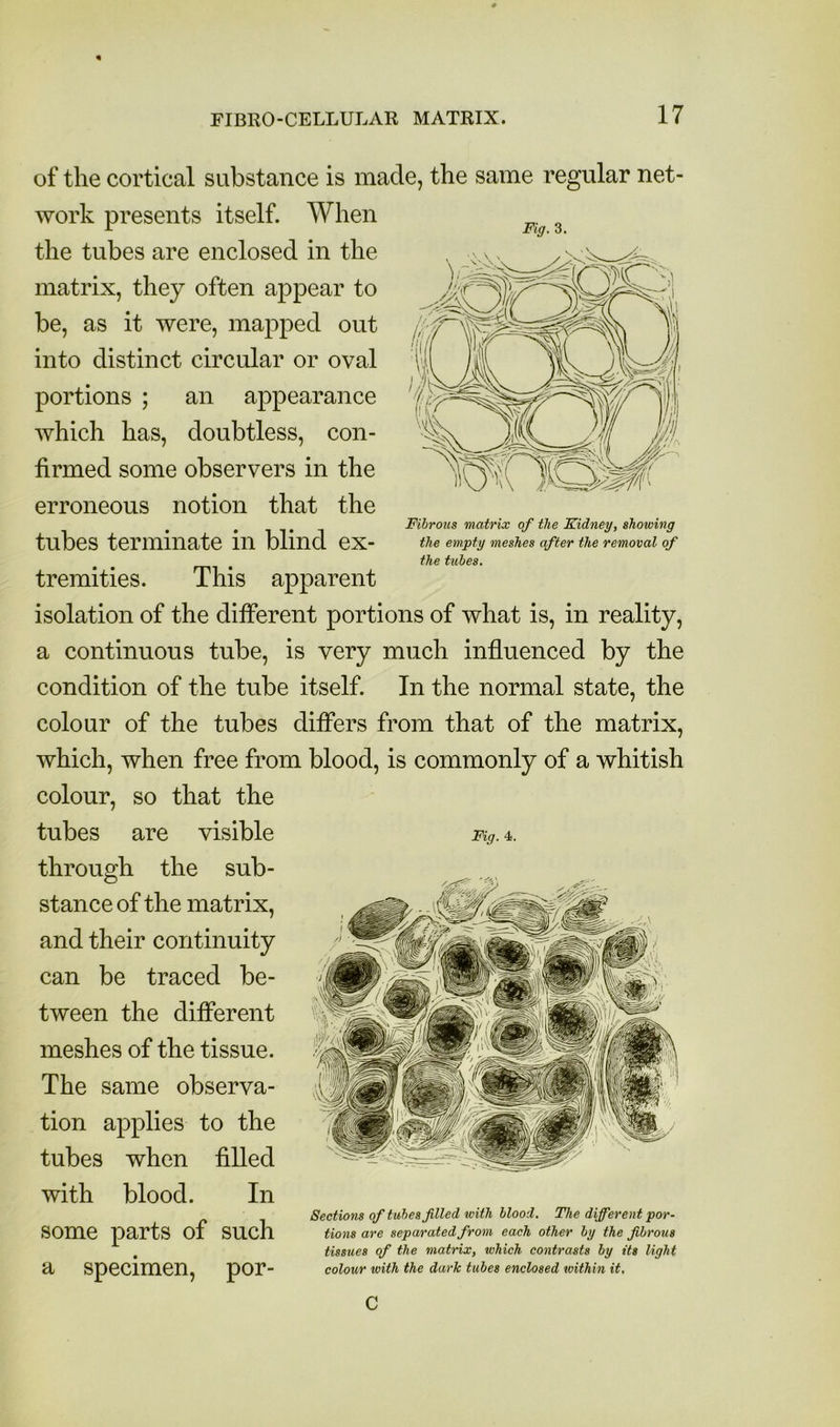 Fig. 3. Fibrous matrix of the Kidney, showing the empty meshes after the removal of the tubes. of the cortical substance is made, the same regular net work presents itself. When the tubes are enclosed in the matrix, they often appear to be, as it were, mapped out into distinct circular or oval portions ; an appearance which has, doubtless, con- firmed some observers in the erroneous notion that the tubes terminate in blind ex- tremities. This apparent isolation of the different portions of what is, in reality, a continuous tube, is very much influenced by the condition of the tube itself. In the normal state, the colour of the tubes differs from that of the matrix, which, when free from blood, is commonly of a whitish colour, so that the tubes are visible Fig. 4. through the sub- stance of the matrix, and their continuity can be traced be- tween the different meshes of the tissue. The same observa- tion applies to the tubes when filled with blood. In some parts of such a specimen, por- Sections of tubes filled with blood. The differen t por- tions are separated from each other by the fibrous tissues of the matrix, which contrasts by its light colour with the dark tubes enclosed within it. c