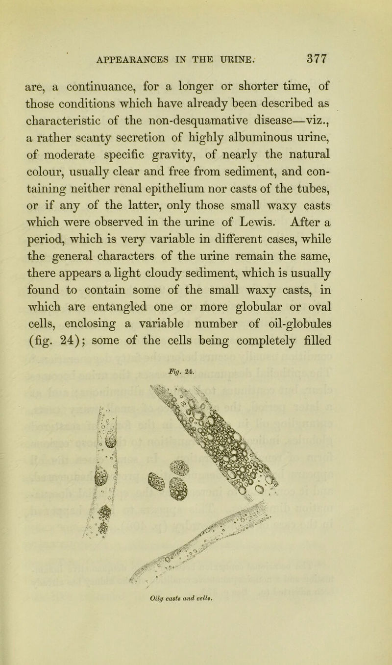 are, a continuance, for a longer or shorter time, of those conditions which have already been described as characteristic of the non-desquamative disease—viz., a rather scanty secretion of highly albuminous urine, of moderate specific gravity, of nearly the natural colour, usually clear and free from sediment, and con- taining neither renal epithelium nor casts of the tubes, or if any of the latter, only those small waxy casts which were observed in the urine of Lewis. After a period, which is very variable in different cases, while the general characters of the urine remain the same, there appears a light cloudy sediment, which is usually found to contain some of the small waxy casts, in which are entangled one or more globular or oval cells, enclosing a variable number of oil-globules (fig. 24); some of the cells being completely filled Fig. 24. Oilg casts and cells.