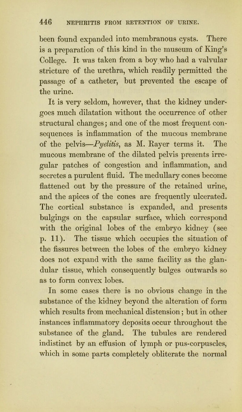 been found expanded into membranous cysts. There is a preparation of this kind in the museum of King’s College. It was taken from a boy who had a valvular stricture of the urethra, which readily permitted the passage of a catheter, but prevented the escape of the urine. It is very seldom, however, that the kidney under- goes much dilatation without the occurrence of other structural changes; and one of the most frequent con- sequences is inflammation of the mucous membrane of the pelvis—Pyelitis^ as M. Rayer terms it. The mucous membrane of the dilated pelvis presents irre- gular patches of congestion and inflammation, and secretes a purulent fluid. The medullary cones become flattened out by the pressure of the retained urine, and the apices of the cones are frequently ulcerated. The cortical substance is expanded, and presents bulgings on the capsular surface, which correspond with the original lobes of the embryo kidney (see p. 11). The tissue which occupies the situation of the fissures between the lobes of the embryo kidney does not expand with the same facility as the glan- dular tissue, which consequently bulges outwards so as to form convex lobes. In some cases there is no obvious change in the substance of the kidney beyond the alteration of form which results from mechanical distension; but in other instances inflammatory deposits occur throughout the substance of the gland. The tubules are rendered indistinct by an effusion of lymph or pus-corpuscles, which in some parts completely obliterate the normal