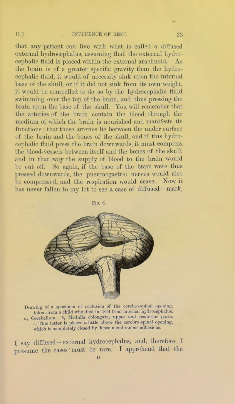 that any patient can live with what is called a diffused external hydrocephalus, assuming that the external hydro- cephalic fluid is placed within the external arachnoid. As the brain is of a greater specific gravity than the hydro- cephalic fluid, it would of necessity sink upon the internal base of the skull, or if it did not sink from its own weight, it would be compelled to do so by the hydrocephalic fluid swimming over the top of the brain, and thus pressing the brain upon the base of the skull. You will remember that the arteries of the brain contain the blood, through the medium of which the brain is nourished and manifests its functions; that those arteries lie between the under surface of the brain and the bones of the skull, and if this hydro- cephalic fluid press the brain downwards, it must compress the blood-vessels between itself and the bones of the skull, and in that way the supply of blood to the brain would be cut off. So again, if the base of the brain were thus pressed downwards, the pneumogastric nerves would also be compressed, and the respiration would cease. Now it has never fallen to my lot to see a case of diffused—mark, Fig. 6. Drawing of a specimen of occlusion of the cerebro-spinal opening, taken from a child who died in 1844 from internal hydrocephalus. a Cerebellum, b, Medulla oblongata, upper and posterior parts. c This letter is placed a little above the cerebro-spinal opening, which is completely closed by dense membranous adhesions. I say diffused—external hydrocephalus, and, therefore, I presume the cases’must be rare. I apprehend that the D