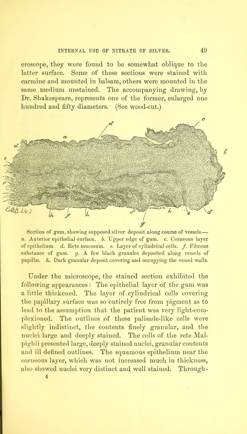 croscope, they were found to be somewhat oblique to the latter surface. Some of these sections were stained with carmine and mounted in balsam, others were mounted in the same medium unstained. The accompanying drawing, by Dr. Shakespeare, represents one of the former, enlarged one hundred and fifty diameters. (See wood-cut.) c y Section of gum, showing supposed silver deposit along course of vessels.— a. Anterior epithelial surface, b. Upper edge of gum. c. Corneous layer of epithelium, d. Rete mucosum. e. Layer of cylindrical cells. /. Fibrous substance of gum. g. A few black granules deposited along vessels of papillae, h. Dark granular deposit covering and occupying the vessel walls. Under the microscope, the stained section exhibited the following appearances : The epithelial layer of the gum was a little thickened. The layer of cylindrical cells covering the papillary surface was so entirely free from pigment as to lead to the assumption that the patient was very light-com- plexioned. The outlines of these palisade-like cells were slightly indistinct, the contents finely granular, and the nuclei large and deeply stained. The cells of the rete Mal- pighi i presented large, deeply stained nuclei, granular contents and ill defined outlines. The squamous epithelium near the corneous layer, which was not increased much in thickness, also showed nuclei very distinct and well stained. Through- 4