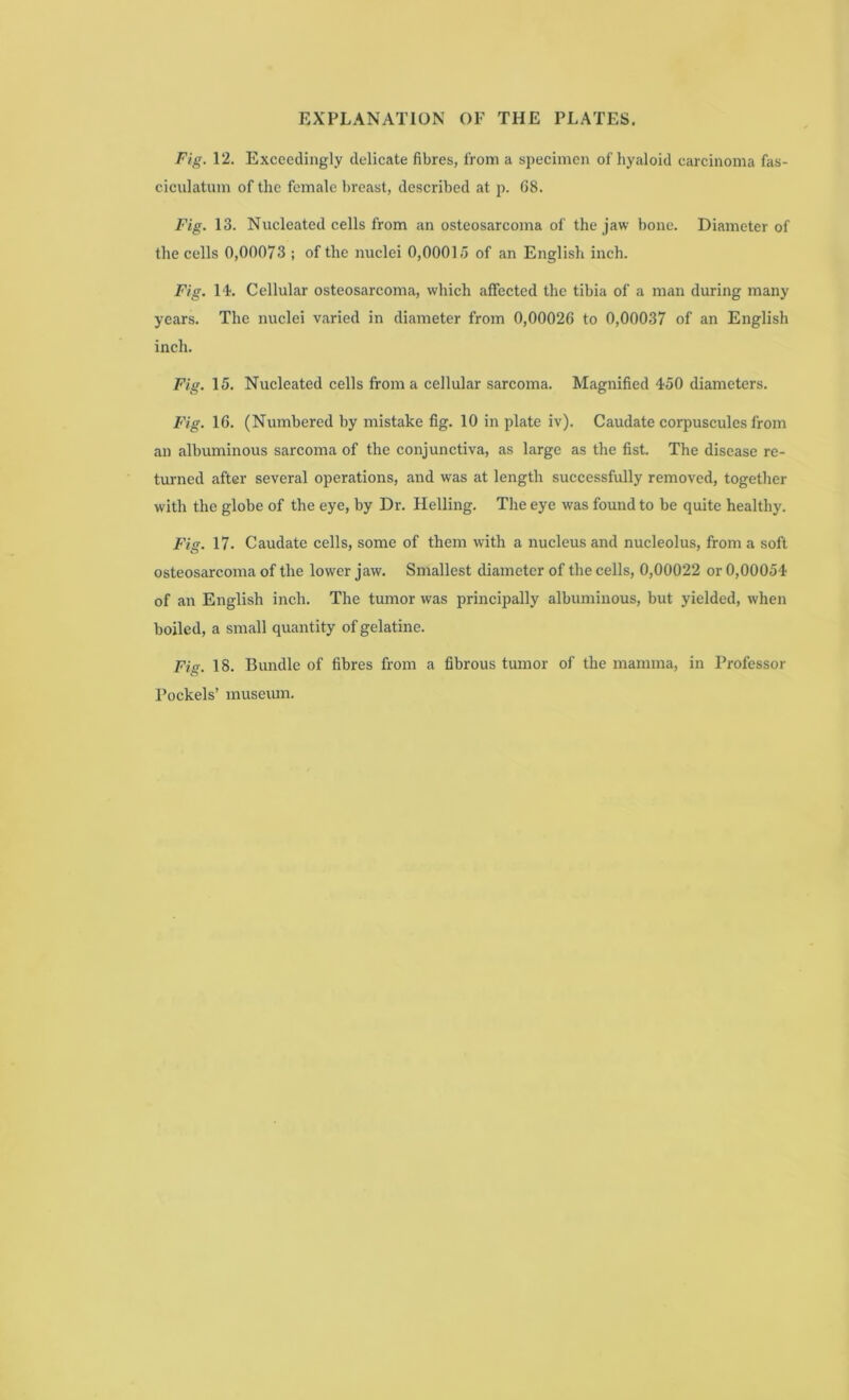 Fig. 12. Exceedingly delicate fibres, from a specimen of hyaloid carcinoma fas- ciculatum of the female breast, described at p. 68. Fig. 13. Nucleated cells from an osteosarcoma of the jaw bone. Diameter of the cells 0,00073 ; of the nuclei 0,00015 of an English inch. Fig. 14. Cellular osteosarcoma, which affected the tibia of a man during many years. The nuclei varied in diameter from 0,00026 to 0,00037 of an English inch. Fig. 15. Nucleated cells from a cellular sarcoma. Magnified 450 diameters. Fig. 16. (Numbered by mistake fig. 10 in plate iv). Caudate corpuscules from an albuminous sarcoma of the conjunctiva, as large as the fist. The disease re- turned after several operations, and was at length successfully removed, together with the globe of the eye, by Dr. Helling. The eye was found to be quite healthy. Fig. 17. Caudate cells, some of them with a nucleus and nucleolus, from a soft osteosarcoma of the lower jaw. Smallest diameter of the cells, 0,00022 or 0,00054 of an English inch. The tumor was principally albuminous, but yielded, when boiled, a small quantity of gelatine. Fig. 18. Bundle of fibres from a fibrous tumor of the mamma, in Professor Pockels’ museum.