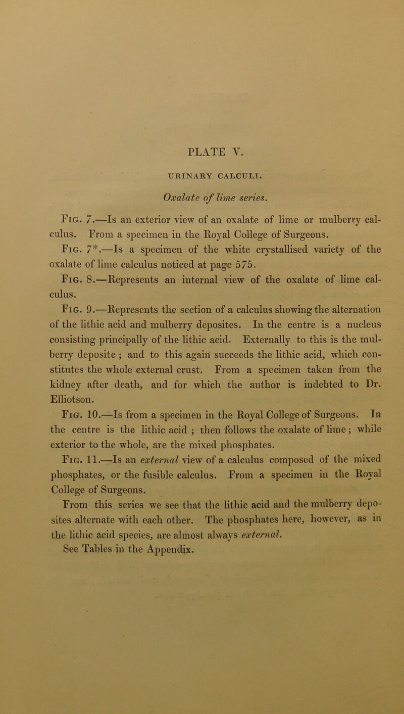 URINARY CALCULI. Oxalate of lime series. Fig. 7.—Is an exterior view of an oxalate of lime or mulberry cal- culus. From a specimen in the Royal College of Surgeons. Fig. 7*.—Is a specimen of the white crystallised variety of the oxalate of lime calculus noticed at page 575. Fig. 8.—Represents an internal view of the oxalate of lime cal- culus. Fig. 9.—Represents the section of a calculus showing the alternation of the lithic acid and mulberry deposites. In the centre is a nucleus consisting principally of the lithic acid. Externally to this is the mul- berry deposite ; and to this again succeeds the lithic acid, which con- stitutes the whole external crust. From a specimen taken from the kidney after death, and for which the author is indebted to Dr. Elliotson. Fig. 10.—Is from a specimen in the Royal College of Surgeons. In the centre is the lithic acid ; then follows the oxalate of lime; while exterior to the whole, are the mixed phosphates. Fig. 11.—Is an external view of a calculus composed of the mixed phosphates, or the fusible calculus. From a specimen in the Royal College of Surgeons. From this series we see that the lithic acid and the mulberry depo- sites alternate with each other. The phosphates here, however, as in the lithic acid species, are almost always external. See Tables in the Appendix.