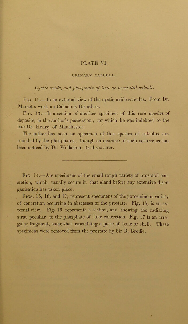 URINARY CALCULI. Cystic oxide, and phosphate of lime or vrostatal calculi. Fig. 12.—Is an external view of the cystic oxide calculus. From Dr. Marcet’s work on Calculous Disorders. Fig. 13.—Is a section of another specimen of this rare species of deposite, in the author’s possession ; for which he was indebted to the late Dr. Henrv, of Manchester. •j * The author has seen no specimen of this species of calculus sur- rounded by the phosphates ; though an instance of such occurrence has been noticed by Dr. Wollaston, its discoverer. Fig. 14.—Are specimens of the small rough variety of prostatal con- cretion, which usually occurs in that gland before any extensive disor- ganisation has taken place. Figs. 15, 16, and 17, represent specimens of the porcelainous variety of concretion occurring in abscesses of the prostate. Fig. 15, is an ex- ternal view. Fig. 16 represents a section, and showing the radiating striae peculiar to the phosphate of lime concretion. Fig. 17 is an irre- gular fragment, somewhat resembling a piece of bone or shell. These specimens were removed from the prostate by Sir B. Brodie.