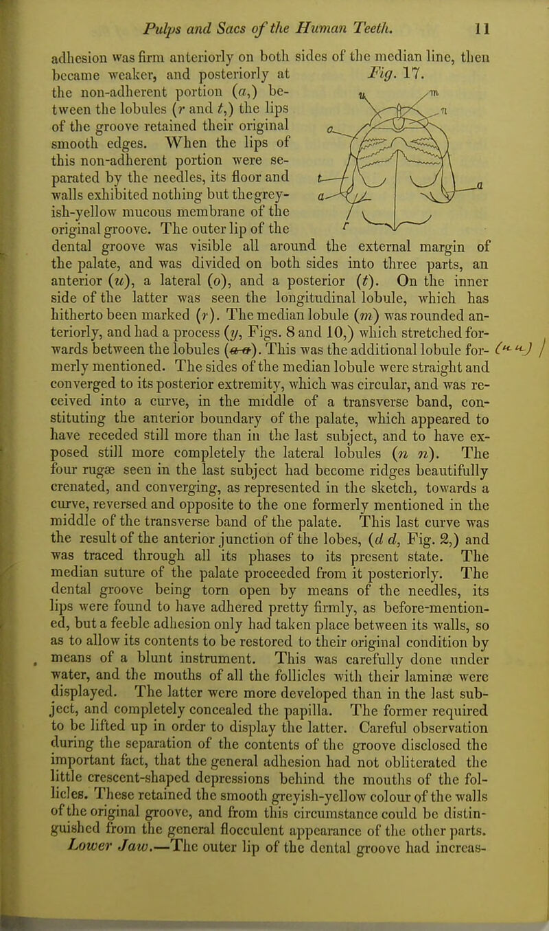 adhesion was firm anteriorly on both sides of the median line, then became weaker, and posteriorly at Fig. 17. the non-adherent portion (a,) be- tween the lobules (r and t,) the lips of the groove retained their original smooth edges. When the lips of this non-adherent portion were se- parated by the needles, its floor and walls exhibited nothing but thegrey- ish-yellow mucous membrane of the original groove. The outer lip of the dental groove was visible all around the external margin of the palate, and was divided on both sides into three parts, an anterior (u), a lateral (o), and a posterior {t). On the inner side of the latter was seen the longitudinal lobule, which has hitherto been marked (r). The median lobule (m) was rounded an- teriorly, and had a process (y, Figs. 8 and 10,) which stretched for- wards between the lobules This was the additional lobule for- merly mentioned. The sides of the median lobule were straight and converged to its posterior extremity, which was circular, and was re- ceived into a curve, in the middle of a transverse band, con- stituting the anterior boundary of the palate, which appeared to have receded still more than in the last subject, and to have ex- posed still more completely the lateral lobules (n n). The four rugae seen in the last subject had become ridges beautifully crenated, and converging, as represented in the sketch, towards a curve, reversed and opposite to the one formerly mentioned in the middle of the transverse band of the palate. This last curve was the result of the anterior junction of the lobes, ((/ d, Fig. 2,) and was traced through all its phases to its present state. The median suture of the palate proceeded from it posteriorly. The dental groove being torn open by means of the needles, its lips were found to have adhered pretty firmly, as before-mention- ed, but a feeble adhesion only had taken place between its walls, so as to allow its contents to be restored to their original condition by means of a blunt instrument. This was carefully done under water, and the mouths of all the follicles with their laminae were displayed. The latter were more developed than in the last sub- ject, and completely concealed the papilla. The former required to be lifted up in order to display the latter. Careful observation during the separation of the contents of the groove disclosed the important fact, that the general adhesion had not obliterated the little crescent-shaped depressions behind the mouths of the fol- licles. These retained the smooth greyish-yellow colour of the walls of the original groove, and from this circumstance could be distin- guished from the general flocculent appearance of the other parts. Lower Jaw.—The outer lip of the dental groove had increas-