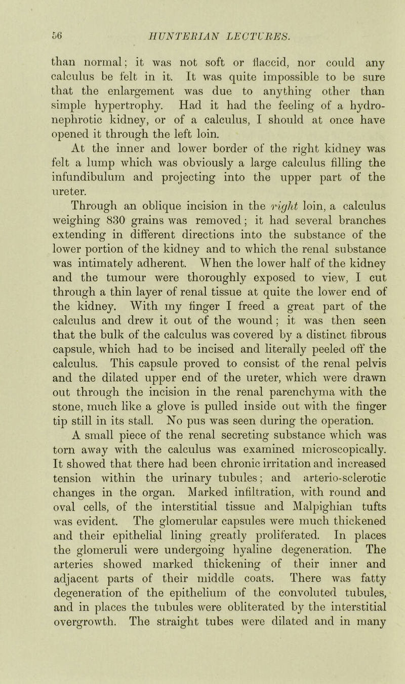 than normal; it was not soft or llaccid, nor could any calculus be felt in it. It was quite impossible to be sure that the enlargement was due to anything other than simple hypertrophy. Had it had the feeling of a hydro- nephrotic kidney, or of a calculus, I should at once have opened it through the left loin. At the inner and lower border of the right kidney was felt a lump which was obviously a large calculus filling the infundibulum and projecting into the upper part of the ureter. Through an oblique incision in the right loin, a calculus weighing 830 grains Avas removed; it had several branches extending in different directions into the substance of the lower portion of the kidney and to which the renal substance Avas intimately adherent. When the loAver half of the kidney and the tumour Avere thoroughly exposed to vieAv, I cut through a thin layer of renal tissue at quite the loAver end of the kidney. With my finger I freed a great part of the calculus and dreAv it out of the wound; it Avas then seen ✓ that the bulk of the calculus Avas covered by a distinct fibrous capsule, Avhich had to be incised and literally peeled off the calculus. This capsule proved to consist of the renal pelvis and the dilated upper end of the ureter, Avhich Avere draAvn out through the incision in the renal parenchyma Avith the stone, much like a glove is pulled inside out Avith the finger tip still in its stall. No pus Avas seen during the operation. A small piece of the renal secreting substance Avhich was torn aAvay Avith the calculus was examined microscopically. It shoAved that there had been chronic irritation and increased tension Avithin the urinary tubules; and arterio-sclerotic changes in the organ. Marked infiltration, Avith round and oval cells, of the interstitial tissue and Malpighian tufts AA-as evident. The glomerular capsules Avere much thickened and their epithelial lining greatly proliferated. In places the glomeruli Avere undergoing hyaline degeneration. The arteries shoAved marked thickening of their inner and adjacent parts of their middle coats. There Avas fatty degeneration of the epithelium of the convoluted tubules, and in places the tubules Avere obliterated by the interstitial overgroAvth. The straight tubes were dilated and in many