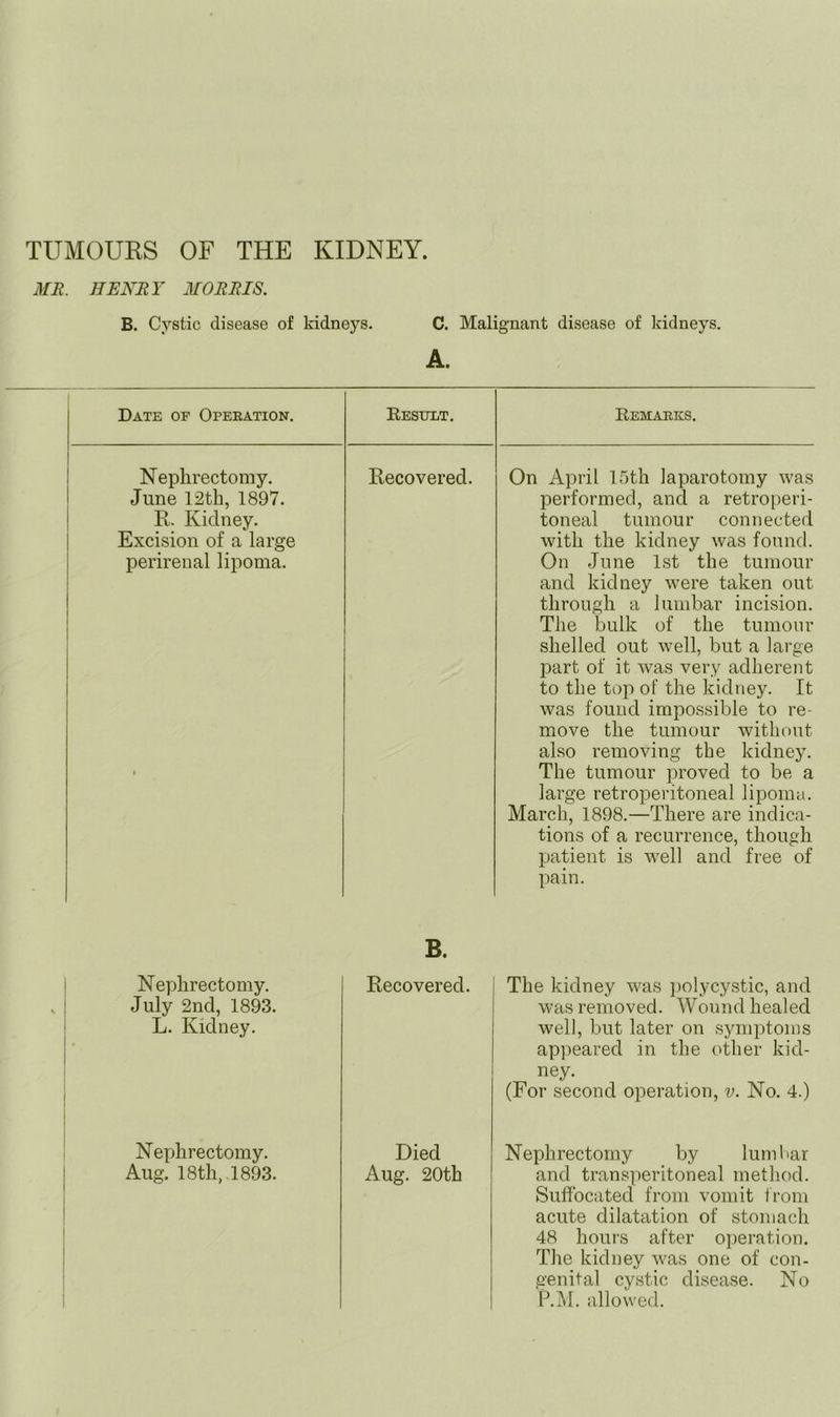 TUMOURS OF THE KIDNEY. MR. HENRY MORRIS. B. Cystic disease of kidneys. C. Malignant disease of kidneys. A. Date of Operation. Result. Remarks. 1 Nephrectomy, j June 12tb, 1897. j R. Kidney. Excision of a large perirenal lipoma. 1 1 1 1 j i 1 1 1 Recovered. On April 15th laparotomy was performed, and a retroperi- toneal tumour connected with the kidney was found. On June 1st the tumour and kidney were taken out through a lumbar incision. The bulk of the tumour shelled out well, but a large part of it was very adherent to the top of the kidney. It was found impossible to re- move the tumour without also removing the kidney. The tumour proved to be a large retroperitoneal lipoma. March, 1898.—There are indica- tions of a recurrence, though patient is w^ell and free of pain. B. Nephrectomy. July 2nd, 1893. L. Kidney. Recovered. The kidney was polycystic, and was removed. Wound healed well, but later on symptoms appeared in the other kid- ney. (For second operation, v. No. 4.) Nephrectomy. Aug. 18 th, 1893. Died Aug. 20th Nephrectomy by lumhar and transperitoneal method. Suffocated from vomit from acute dilatation of stomach 48 hours after operation. The kidney was one of con- genital cystic disease. No P.M. allowed.