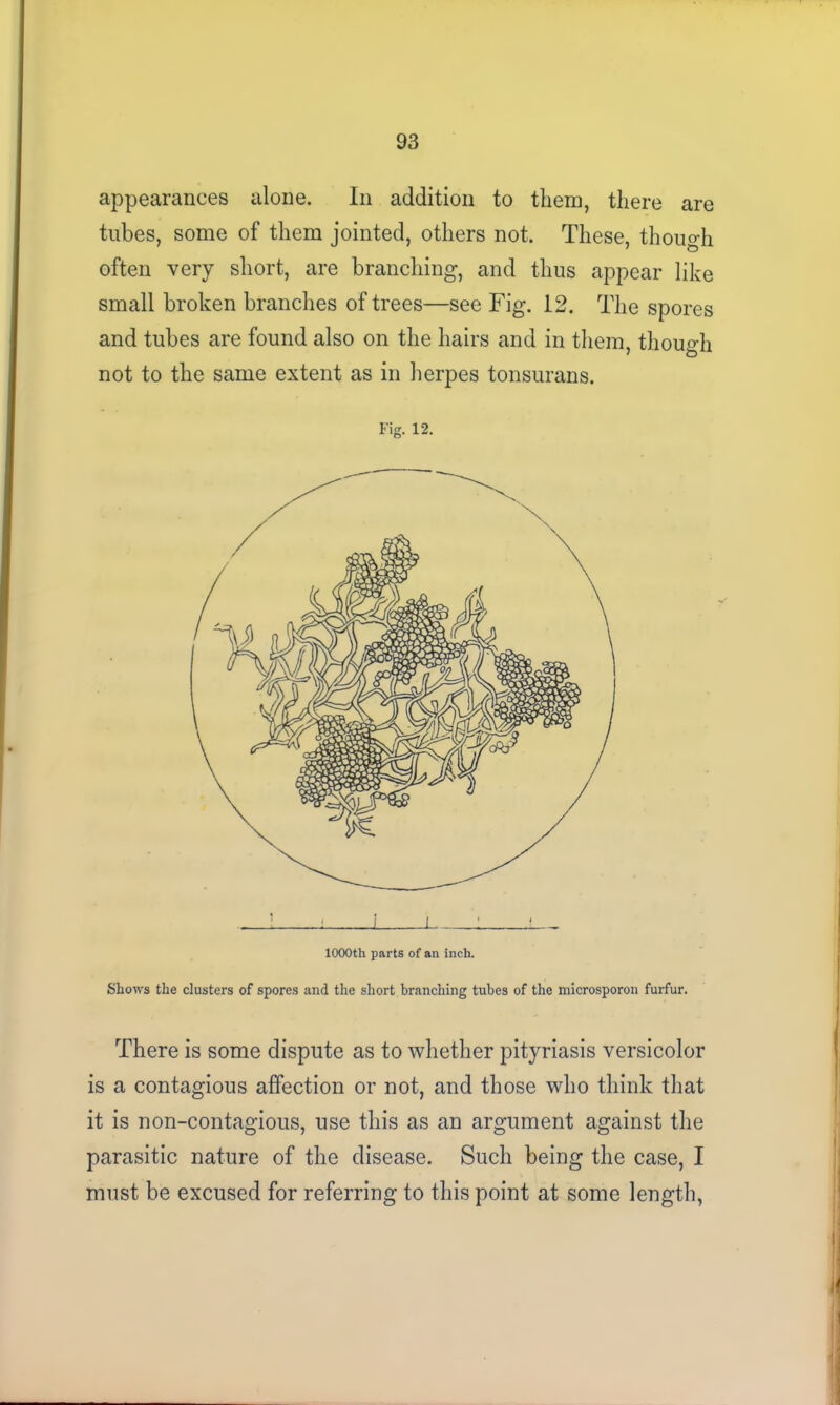 appearances alone. In addition to them, there are tubes, some of them jointed, others not. These, though often very short, are branching, and thus appear like small broken branches of trees—see Fig. 12. The spores and tubes are found also on the hairs and in them, though not to the same extent as in herpes tonsurans. Fig. 12. 1000th parts of an inch. Shows the clusters of spores and the short branching tubes of the microsporon furfur. There is some dispute as to whether pityriasis versicolor is a contagious affection or not, and those who think that it is non-contagious, use this as an argument against the parasitic nature of the disease. Such being the case, I must be excused for referring to this point at some length,