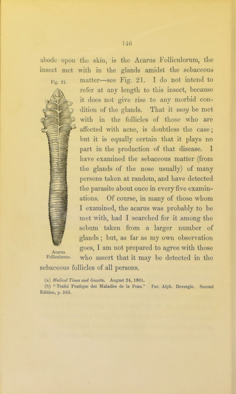 abode upon the skin, is the Accarus Folliculorum, the insect met with in the glands amidst the sebaceous rig. 21. matter—see Fig. 21. I do not intend to refer at any length to this insect, because it does not give rise to any morbid con- dition of the glands. That it may be met with in the follicles of those who are affected with acne, is doubtless the case; but it is equally certain that it plays no part in the production of that disease. I have examined the sebaceous matter (from the glands of the nose usually) of many persons taken at random, and have detected the parasite about once in every five examin- ations. Of course, in many of those whom I examined, the acarus was probably to be met with, had I searched for it among the sebum taken from a larger number of glands ; but, as far as my own observation goes, I am not prepared to agree with those Acarus Foiiicniorum. w]10 assert that it may be detected in the sebaceous follicles of all persons. (a) Medical Times and Gazette. August 24, 1861. (b) “ Traits Pratique ties Maladies de la Peau.” Par. Alph. Devergie. Second Edition, p. 565.