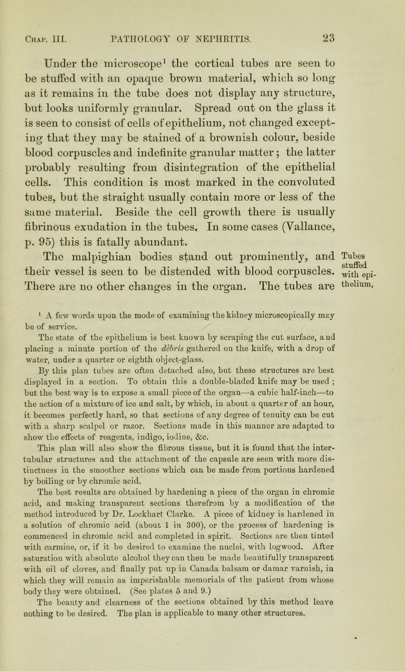 Under tlie microscope1 tlie cortical tubes are seen to be stuffed with an opaque brown material, which so long as it remains in the tube does not display any structure, but looks uniformly granular. Spread out on the glass it is seen to consist of cells of epithelium, not changed except- ing that they may be stained of a brownish colour, beside blood corpuscles and indefinite granular matter; the latter probably resulting from disintegration of the epithelial cells. This condition is most marked in the convoluted tubes, but the straight usually contain more or less of the same material. Beside the cell growth there is usually fibrinous exudation in the tubes. In some cases (Vallance, p. 95) tins is fatally abundant. The malpighian bodies stand out prominently, and their vessel is seen to be distended with blood corpuscles. There are no other changes in the organ. The tubes are 1 A few words upon the mode of examining the kidney microscopically may he of service. The state of the epithelium is best known by scraping the cut surface, and placing a minute portion of the debris gathered on the knife, with a drop of water, under a quarter or eighth object-glass. By this plan tubes are often detached also, but these structures are best displayed in a section. To obtain this a double-bladed knife may be used ; but the best way is to expose a small piece of the organ—a cubic half-inch—to the action of a mixture of ice and salt, by which, in about a quarter of an hour, it becomes perfectly hard, so that sections of any degree of tenuity can be cut with a sharp scalpel or razor. Sections made in this manner are adapted to show the effects of reagents, indigo, iodine, &c. This plan will also show the fibrous tissue, but it is found that the inter- tubular structures and the attachment of the capsule are seen with more dis- tinctness in the smoother sections which can be made from portions hardened by boiling or by chromic acid. The best results are obtained by hardening a piece of the organ in chromic acid, and making transparent sections therefrom by a modification of the method introduced by Dr. Lockhart Clarke. A piece of kidney is hardened in a solution of chromic acid (about 1 in 300), or the process of hardening is commenced in chromic acid and completed in spirit. Sections are then tinted with carmine, or, if it be desired to examine the nuclei, with logwood. After saturation with absolute alcohol they can then be made beautifully transparent with oil of cloves, and finally put up in Canada balsam or damar varnish, in which they will remain as imperishable memorials of the patient from whose body they were obtained. (See plates 5 and 9.) The beauty and clearness of the sections obtained by this method leave nothing to be desired. The plan is applicable to many other structures. Tubes stuffed with epi- thelium,