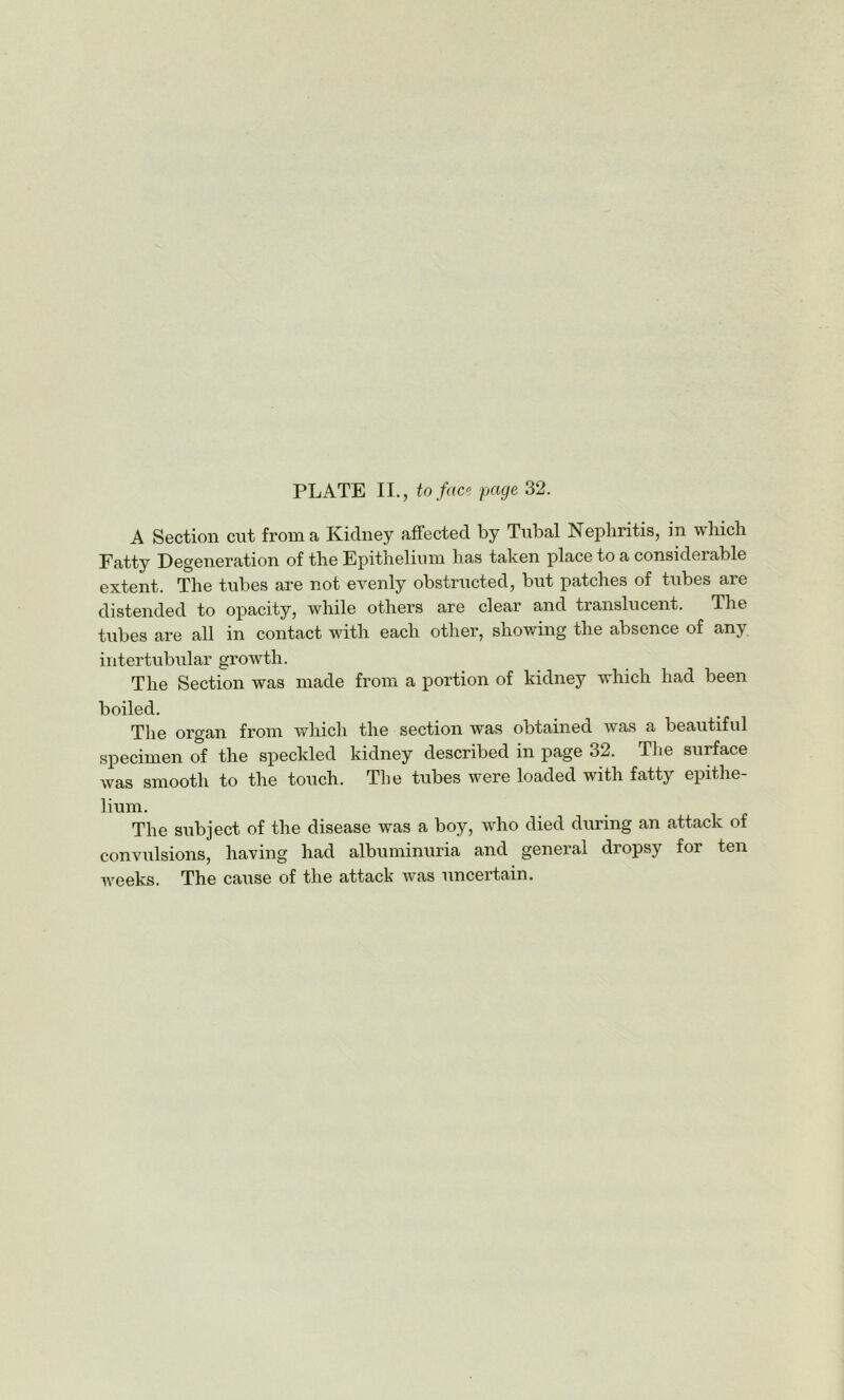 PLATE II., to face page 32. A Section cot from a Kidney affected by Tubal Nephritis, in which Fatty Degeneration of the Epithelium has taken place to a considerable extent. The tubes are not evenly obstructed, but patches of tubes are distended to opacity, while others are clear and translucent. The tubes are all in contact with each other, showing the absence of any intertubular growth. The Section was made from a portion of kidney which had been boiled. The organ from which the section was obtained was a beautiful specimen of the speckled kidney described in page 32. The surface was smooth to the touch. The tubes were loaded with fatty epithe- lium. The subject of the disease was a boy, who died during an attack of convulsions, having had albuminuria and general dropsy for ten weeks. The cause of the attack was uncertain.
