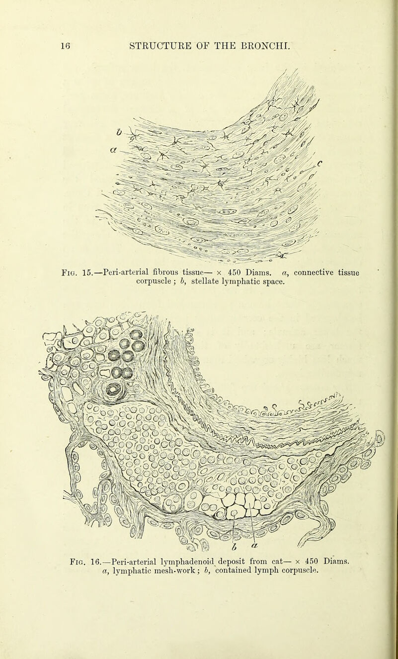 Fig. 15.—Peri-arterial fibrous tissue— x 450 Diams. a, connective tissue corpuscle ; 6, stellate lymphatic space. Fig. 16.—Peri-arterial lymphadenoid deposit from cat— x 450 Diams. a, lymphatic mesh-work ; b, contained lymph corpuscle.
