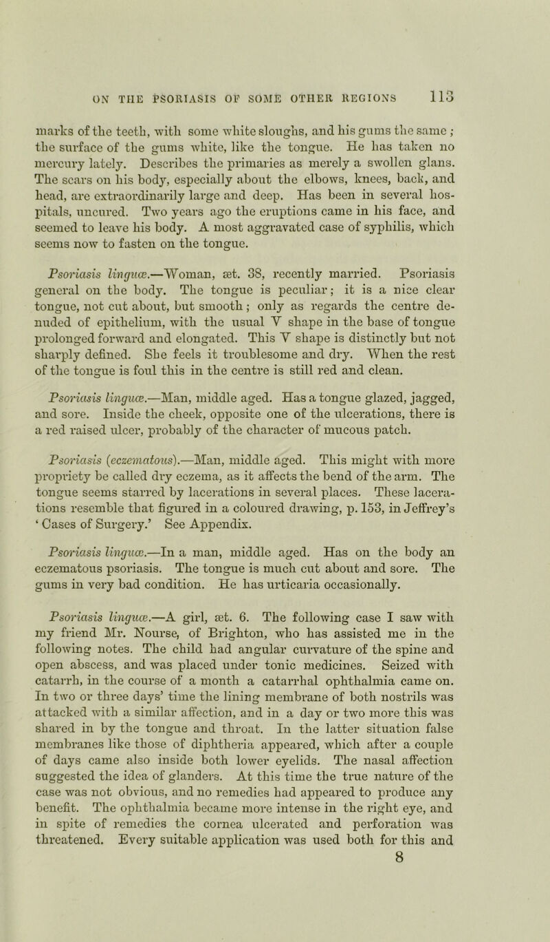 marks of the teeth, with some white sloughs, and his gums the same ; the surface of the gums white, like the tongue. He has taken no mercury lately. Describes the primaries as merely a swollen glans. The scars on his body, especially about the elbows, knees, back, and head, are extraordinarily large and deep. Has been in several hos- pitals, uncured. Two years ago the eruptions came in his face, and seemed to leave his body. A most aggravated case of syphilis, which seems now to fasten on the tongue. Pso7'iasis liiiguaz.—Woman, jet. 38, recently married. Psoriasis general on the body. The tongue is peculiar; it is a nice clear tongue, not cut about, but smooth; only as regards the centre de- nuded of epithelium, with the usual Y shape in the base of tongue prolonged forward and elongated. This Y shape is distinctly but not sharply defined. She feels it troublesome and dry. When the rest of the tongue is foul this in the centre is still red and clean. Psoriasis lingucE.—Man, middle aged. Has a tongue glazed, jagged, and sore. Inside the cheek, opposite one of the ulcerations, there is a red raised ulcer, probably of the character of mucous patch. Psoriasis {eczematous).—Man, middle aged. This might with more propriety be called dry eczema, as it affects the bend of the arm. The tongue seems starred by lacerations in several places. These lacera- tions resemble that figured in a coloured drawing, p. 153, in Jeffrey’s ‘ Cases of Surgery.’ See Appendix. Psoriasis linguce.—In a man, middle aged. Has on the body an eczematous psoriasis. The tongue is much cut about and sore. The gums in very bad condition. He has urticaria occasionally. Psoriasis linguce.—A girl, sst. 6. The following case I saw with my friend Mr. Hourse, of Brighton, who has assisted me in the following notes. The child had angular curvature of the spine and open abscess, and was placed under tonic medicines. Seized with catarrh, in the course of a month a catarrhal ophthalmia came on. In two or three days’ time the lining membrane of both nostrils was attacked with a similar affection, and in a day or two more this was shared in by the tongue and throat. In the latter situation false membranes like those of diphtheria appeared, which after a couple of days came also inside both lower eyelids. The nasal affection suggested the idea of glanders. At this time the true nature of the case was not obvious, and no remedies had appeared to produce any benefit. The ophthalmia became more intense in the right eye, and in spite of remedies the cornea ulcerated and perforation Avas threatened. Every suitable application Avas used both for this and 8