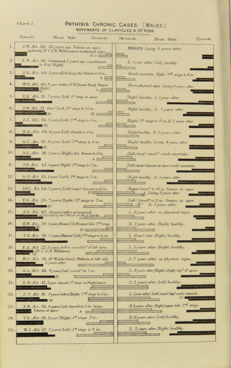 ('hart J. Upwards Phthisis. Chronic Cases. (Males.) MOVEMENTS OF CLAVICLES & 3-DRIBS Worst. Side Forwards Rsrwardt. .BeHt Side. Upwards. ■ L K. L. TO. 5 yearsfljcft)large dry Vomica to 4 in. BB— x W 4-. 5. 6. 7. 8. 8. 10. 11. 12. 31. 2 years (Left) 1sL stage at apex. 8HBBS8—■ r,ww/W, J.W <iEt .17. Svio* (Tsefl) 1st stage to li in namnaMHm ■BBBBi(c) gjg* J. \\. /Tit .b5. 36 years ago. Vomica at apex ^^m(anthimly J)' ( ./. H. Williams) no w no physical signs ® (C) X ivLfflvh K . W. JEt. T8 . Commenced/ 5years ago corveohdaliow 1 to 4 inf Right) i Ml‘S../ht. 4*0 • 9years before I)1. //.Rennet found Vomica X &VktJ IC] vmsTi. (C| v, ,/////%&. J. J • JEt. 35. 2 years pt.efb) 2sdstage to 5 in. 1(C) N.G.^Kt. 26. 6years (Left) deposit to 5in,. 77/7?r,-/;m G.C ■ JEt . 57. lPyears (Left) 2sd stage tc 4-in. ,WW'. D.L JE.t. 2G. 3years/Right,) dry Vomica io 3in. xm%m JD. JEt t. 4*2.4-years (Right) 1st stage to 2 in. G- S .AL t. 25. J year (Left) l9^ stage to .3 in. mzaz/rJflJfk A.W.L. JEt. 54>. “I years (Left(incip * deposit to li in. — wmmm E.G. /Et .25. 7-years(Right) Is? stage to 2 in.. 1(C) J.G. JE t. 02. 34-years before pronounced tie ft, side by Sir TWa.tr rs A Sir. J. Clarke ■ CTZ^TZ ■ (c) H,TV. JE t . 29.1 years(Hcemcjd)Left)upper lobe 2 ^ stage. (C| T- li.JE t. 36. 3 yearsflhxmopf')Left)?xfi stage tdi in . ZZZ777SS/ttzMz2 T. A Afjt .27. 5 years before, cons olid™ of loft apex | mr. C J.B. Williams) 7(1) CZZZZZgZZZgZZZ22^ 10 . | W.C.iKt. 38. DfWodshe found Fhfhisis on left side. 6 years after. G. L. JEt t. ‘L8 . 9 years (Left) consol V to 2 in 1(C) r/77/////7S7777////77S$%ttF, E. S . JEt . 17. lyear deposit, l*stage, at.(Right)apex, Mm/Z/M J. T - JEt .18. 3 years before/Right/ 2Ml stage to 3 in,: \ (O) 23. J.P. JEt. 25.4-yeare (Left) deposit to S in, large. Vomica, at apex ■ T.G. JEt .61.l'yearf.RzgTpt) 1* stage 2in. W-l.-JEt-S?. 2 years (Left) l? stage to 2 itv. Z . lyear aftjm (Left] healthy. Wh/w/w/r.i Result, uncertain Right. Z1,d stage In (r itv. Kow nr physical signs living .9years after. IRight) healthy. L. lyear after. mm*;™ _ HSfyzzzzd (Right) 1st? stage in 7 2 in I). 2 years after. (Right)healthy. D 2 years after. Right) healthy Living 8years after. RESULTS Lhing 5 years after. 7Z22M Right) healthy. L . 7 years after. (Left) in rip1 consol* result uncertain. mZLr, :::::::: (left) incipt deposit at apex result uncertain. IRight) healthy. 71. 3years after. (Right) Consol  to 4 2 in Vomica at apex. (////,$„, -Living 11 years after (Left) Consol'to 3. in. Vomica■ at apex n 2ycar* erft*r- —— L . 5years a fter', iw -physcicaZ signs ZZ7ZLZZZ , '/jV///y ////////. V///A }///////////f/A J). 2years after. (Right) heabtJiy. L . 18 me * after. (Right) healthy. 7....... L. 5years after (Right) healthy. JL . 7 years after, no physical signs. L. 8years after (Right) slight dep? of apex. V/T/r/m //Z///Z/?JZ//w ////7/7A L. 3 years after (Left) healthy. vzzzt-y/zZh m L. 1 year after ( Left) incipT dept under clavicle. J).4years after (Right(upper lobe 2s— stage. L). 10years after.(Left/) healthy Jj . 2 years after Right) hcalihy