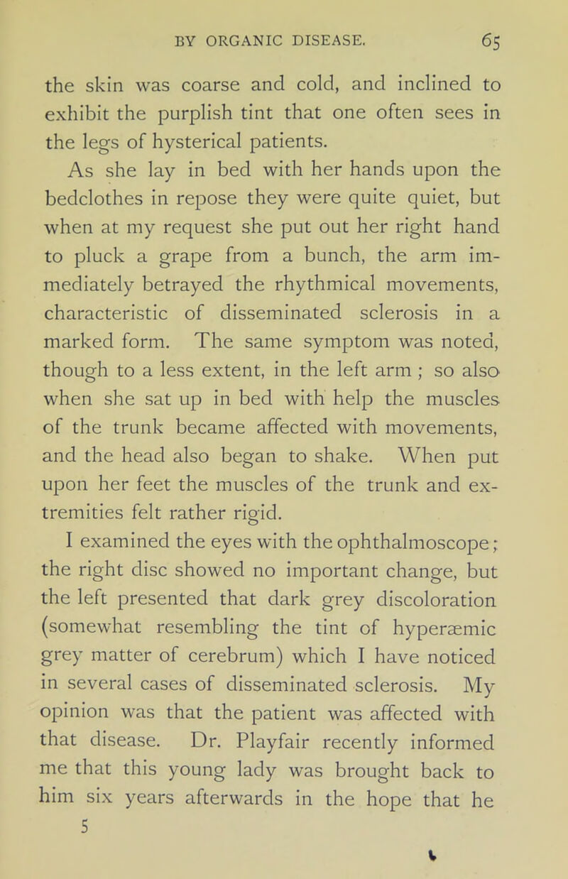 the skin was coarse and cold, and inclined to exhibit the purplish tint that one often sees in the legs of hysterical patients. As she lay in bed with her hands upon the bedclothes in repose they were quite quiet, but when at my request she put out her right hand to pluck a grape from a bunch, the arm im- mediately betrayed the rhythmical movements, characteristic of disseminated sclerosis in a marked form. The same symptom was noted, though to a less extent, in the left arm ; so also when she sat up in bed with help the muscles of the trunk became affected with movements, and the head also began to shake. When put upon her feet the muscles of the trunk and ex- tremities felt rather rioid. O I examined the eyes with the ophthalmoscope; the right disc showed no important change, but the left presented that dark grey discoloration (somewhat resembling the tint of hyperaemic grey matter of cerebrum) which I have noticed in several cases of disseminated sclerosis. My opinion was that the patient was affected with that disease. Dr. Playfair recently informed me that this young lady was brought back to him six years afterwards in the hope that he 5 v