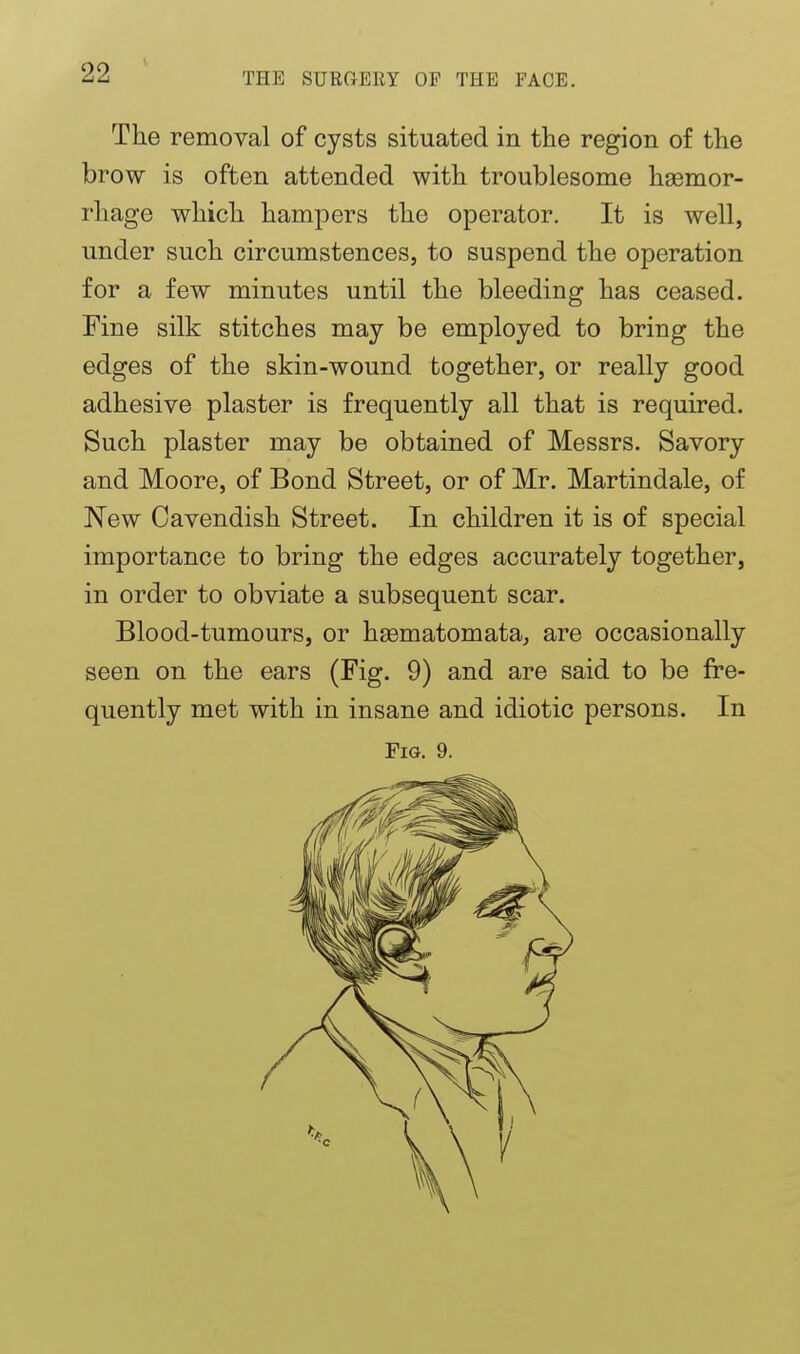 The removal of cysts situated in the region of the brow is often attended with troublesome haemor- rhage which hampers the operator. It is well, under such circumstences, to suspend the operation for a few minutes until the bleeding has ceased. Fine silk stitches may be employed to bring the edges of the skin-wound together, or really good adhesive plaster is frequently all that is required. Such plaster may be obtained of Messrs. Savory and Moore, of Bond Street, or of Mr. Martindale, of New Cavendish Street. In children it is of special importance to bring the edges accurately together, in order to obviate a subsequent scar. Blood-tumours, or hsematomata, are occasionally seen on the ears (Fig. 9) and are said to be fre- quently met with in insane and idiotic persons. In