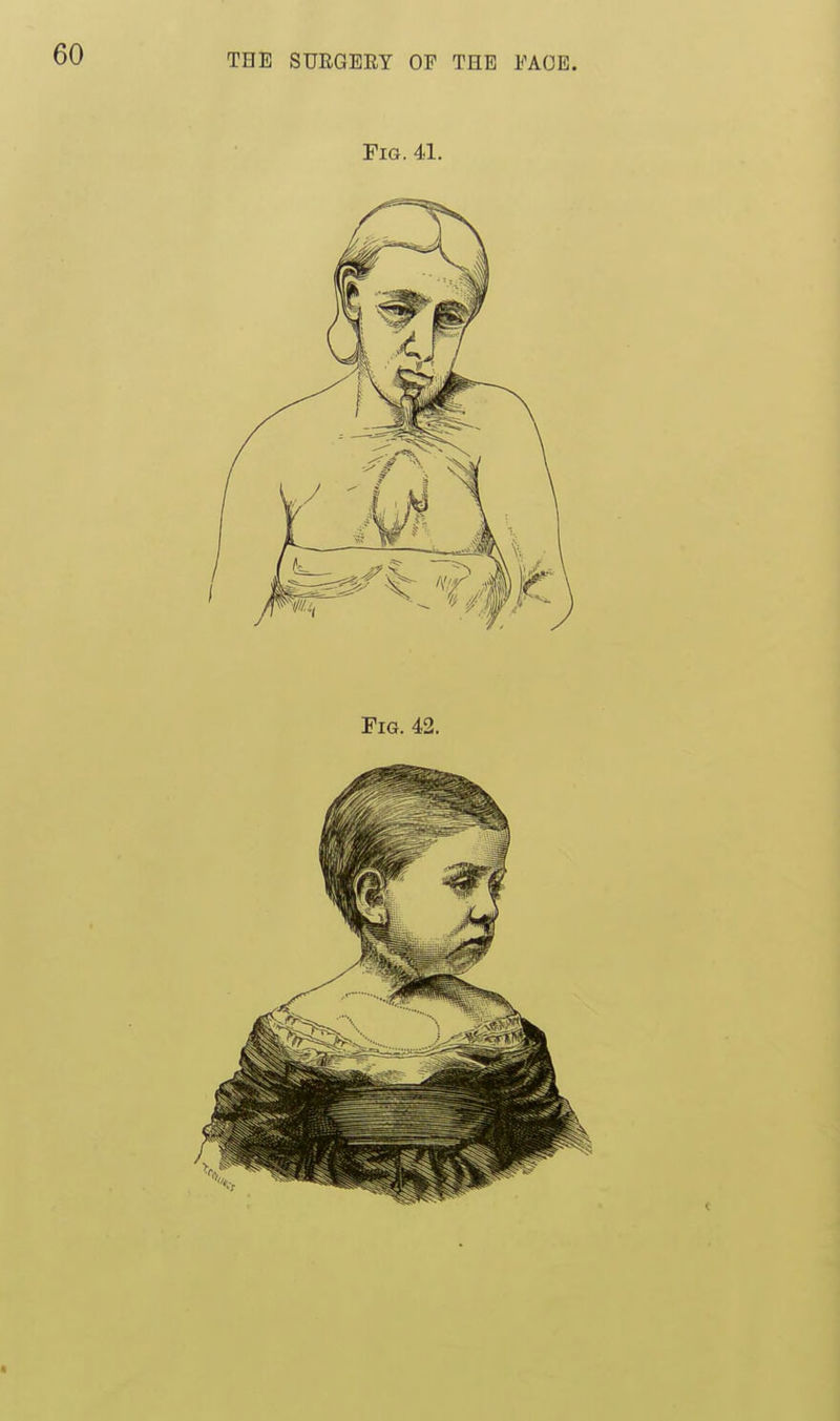 Fig. 41. Fig. 42.
