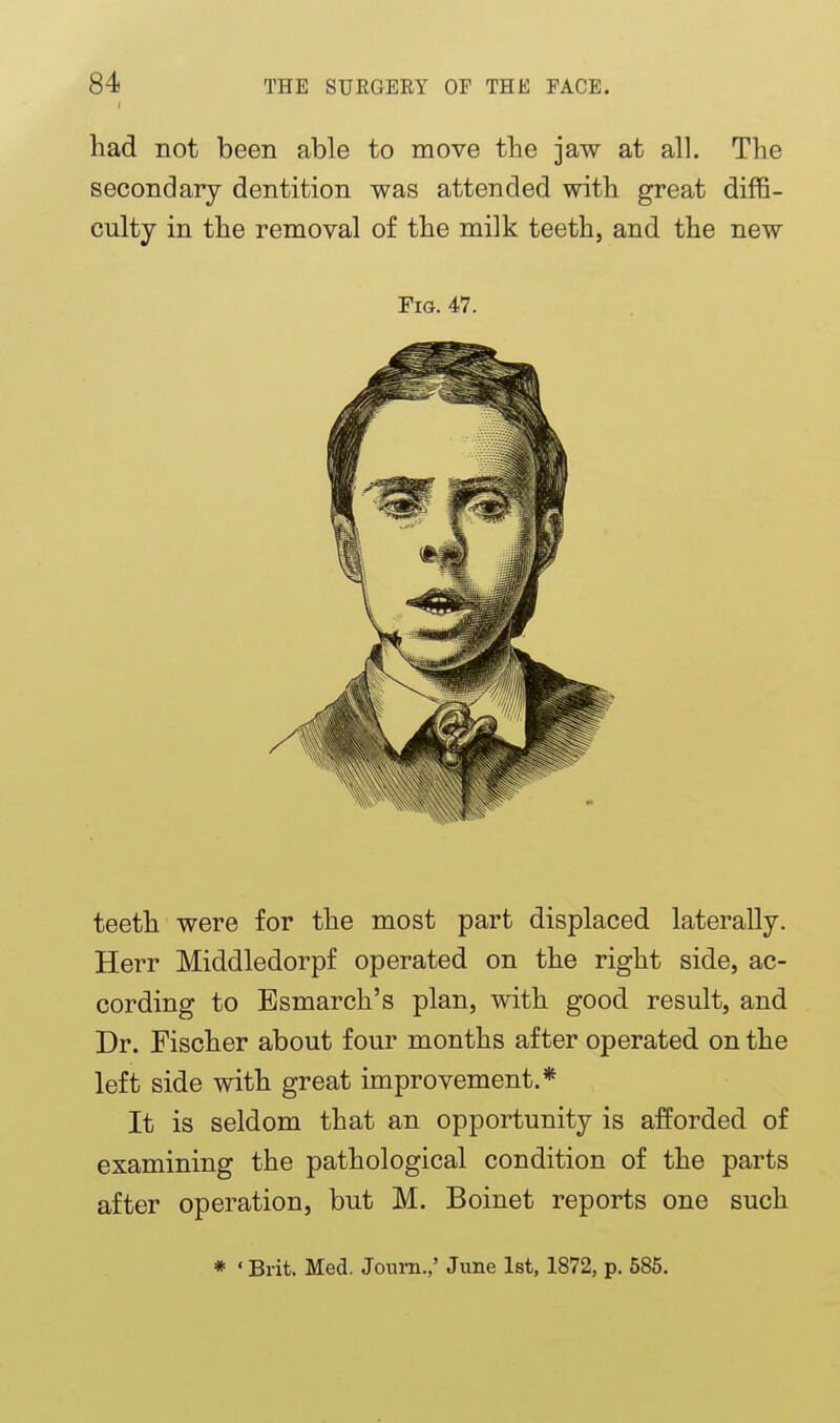 f had not been able to move tlie jaw at all. The secondary dentition was attended with great diffi- culty in the removal of the milk teeth, and the new Fig. 47. teeth were for the most part displaced laterally. Herr Middledorpf operated on the right side, ac- cording to Esmarch's plan, with good result, and Dr. Fischer about four months after operated on the left side with great improvement.* It is seldom that an opportunity is afforded of examining the pathological condition of the parts after operation, but M. Boinet reports one such