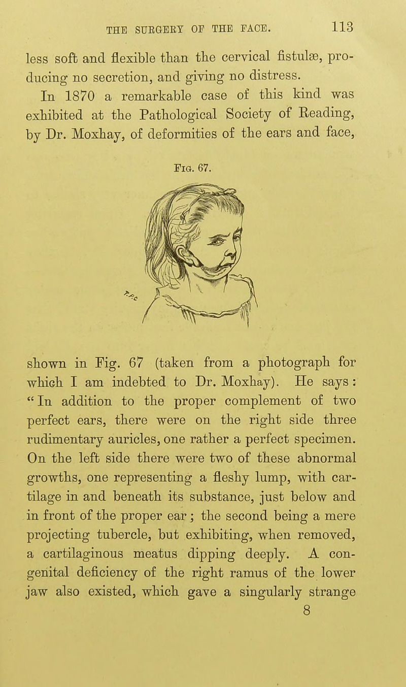 less soft and flexible than the cervical fistula, pro- ducing no secretion, and giving no distress. In 1870 a remarkable case of this kind was exhibited at the Pathological Society of Reading, by Dr. Moxhay, of deformities of the ears and face, Fia. 67. shown in Fig. 67 (taken from a photograph for which I am indebted to Dr. Moxhay). He says :  In addition to the proper complement of two perfect ears, there were on the right side three rudimentary auricles, one rather a perfect specimen. On the left side there were two of these abnormal growths, one representing a fleshy lump, with car- tilage in and beneath its substance, just below and in front of the proper ear; the second being a mere projecting tubercle, but exhibiting, when removed, a cartilaginous meatus dipping deeply. A con- genital deficiency of the right ramus of the lower jaw also existed, which gave a singularly strange