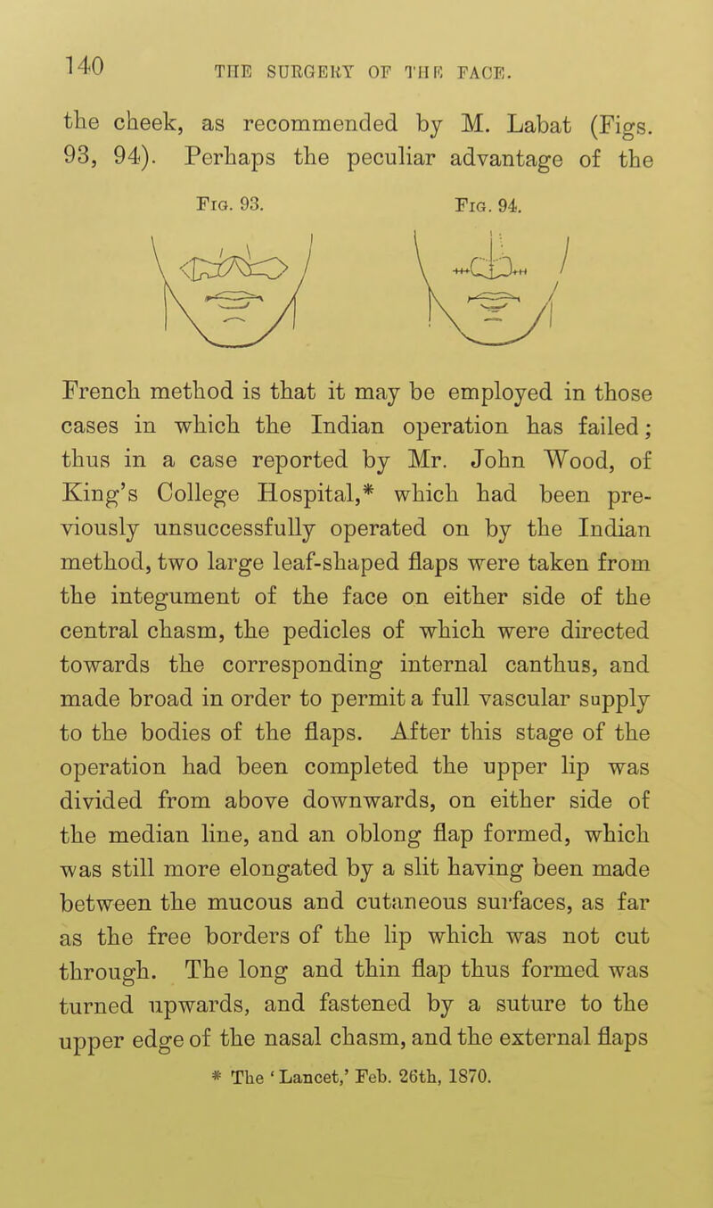 the cheek, as recommended by M. Labat (Figs. 93, 94). Perhaps the peculiar advantage of the Fig. 93. Pig. 94. French method is that it may be employed in those cases in which the Indian operation has failed; thus in a case reported by Mr. John Wood, of King's College Hospital,* which had been pre- viously unsuccessfully operated on by the Indian method, two large leaf-shaped flaps were taken from the integument of the face on either side of the central chasm, the pedicles of which were directed towards the corresponding internal canthus, and made broad in order to permit a full vascular supply to the bodies of the flaps. After this stage of the operation had been completed the upper lip was divided from above downwards, on either side of the median line, and an oblong flap formed, which was still more elongated by a slit having been made between the mucous and cutaneous surfaces, as far as the free borders of the lip which was not cut through. The long and thin flap thus formed was turned upwards, and fastened by a suture to the upper edge of the nasal chasm, and the external flaps * The ' Lancet,' Feb. 26tli, 1870.